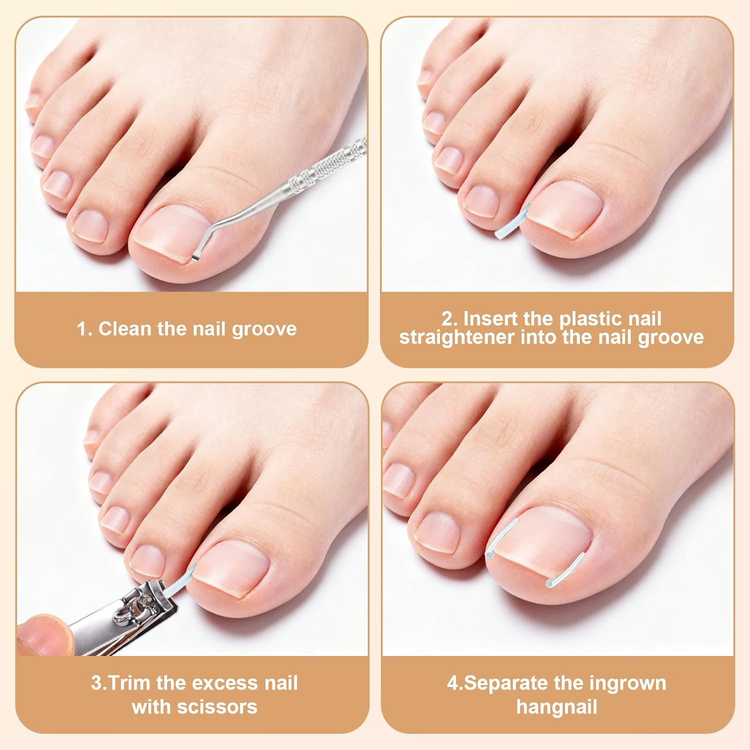 Ingrown Toenail Tool Set, Feet Pedicure Tools with Nail File & Clippers Skin Bevel Knife Toenail Groove Pick & Spoon Nail Stickers for Men Women Pedicure Tool
