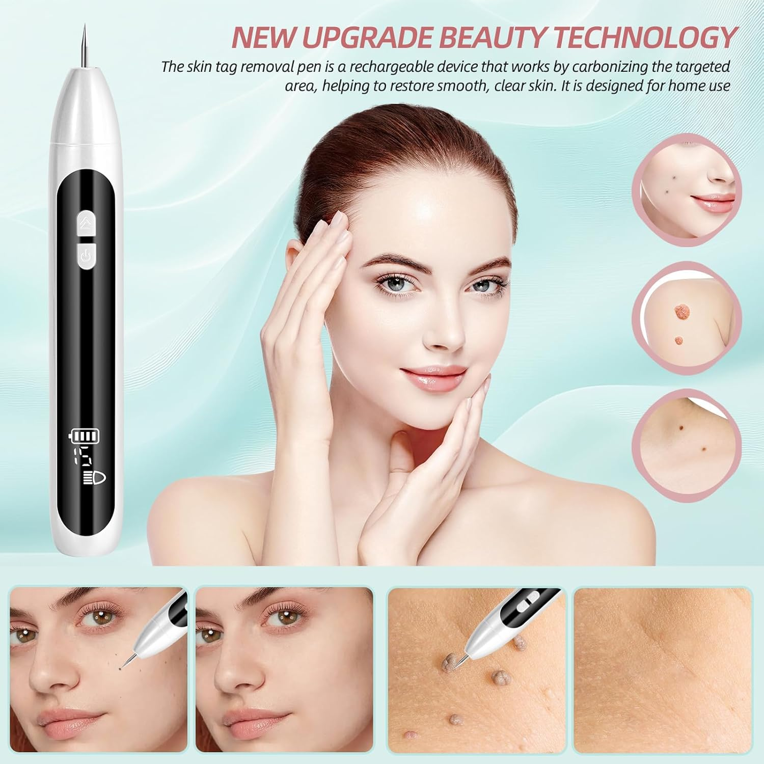 AL-40 Skin Removal Kit, Design to Smooth Your Skin, Safe and Effective for Home Use, Easy to Use Skin Tag Remover Kit image number 1