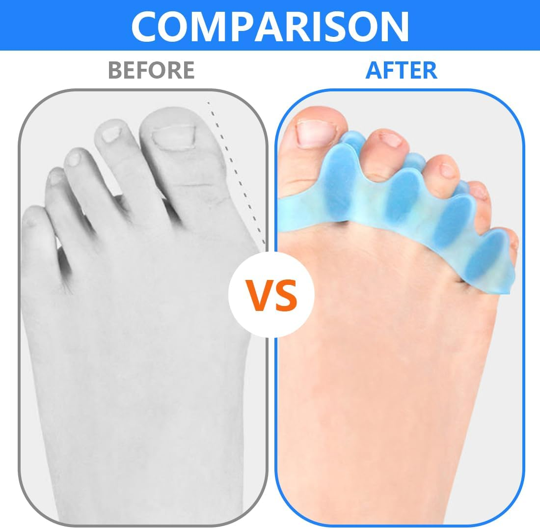 BEPSYOM 4 Pairs Toe Spacer Silicone Toe Separator Hallux Valgus Correction, 8 Pieces Toe Separator Toe Separator for All Toes, Men and Women image number 5