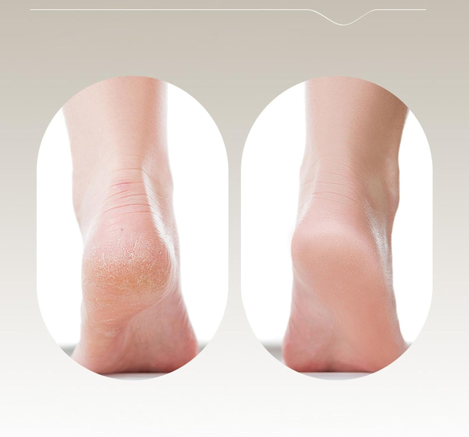 Foot Callus Remover | Pedicure Grinder Tool | Multipurpose Dead Skin Callus Remover for Daily Maintenance Pedicure Spa Travel Home Adults Seniors