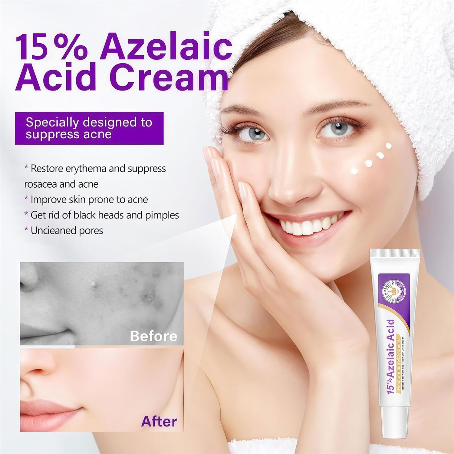 Ai-Uchoice Azelaic Acid 10% Cream for Face Body, 0.7 OZ Azelaic Acid Acne Cream Gel with Salicylic Acid for Skin Balancing Nourishing for Sensitive Skin Care & Daily Routines (Ai-Uchoice, 15% Azelaic Acid Cream) image number 5