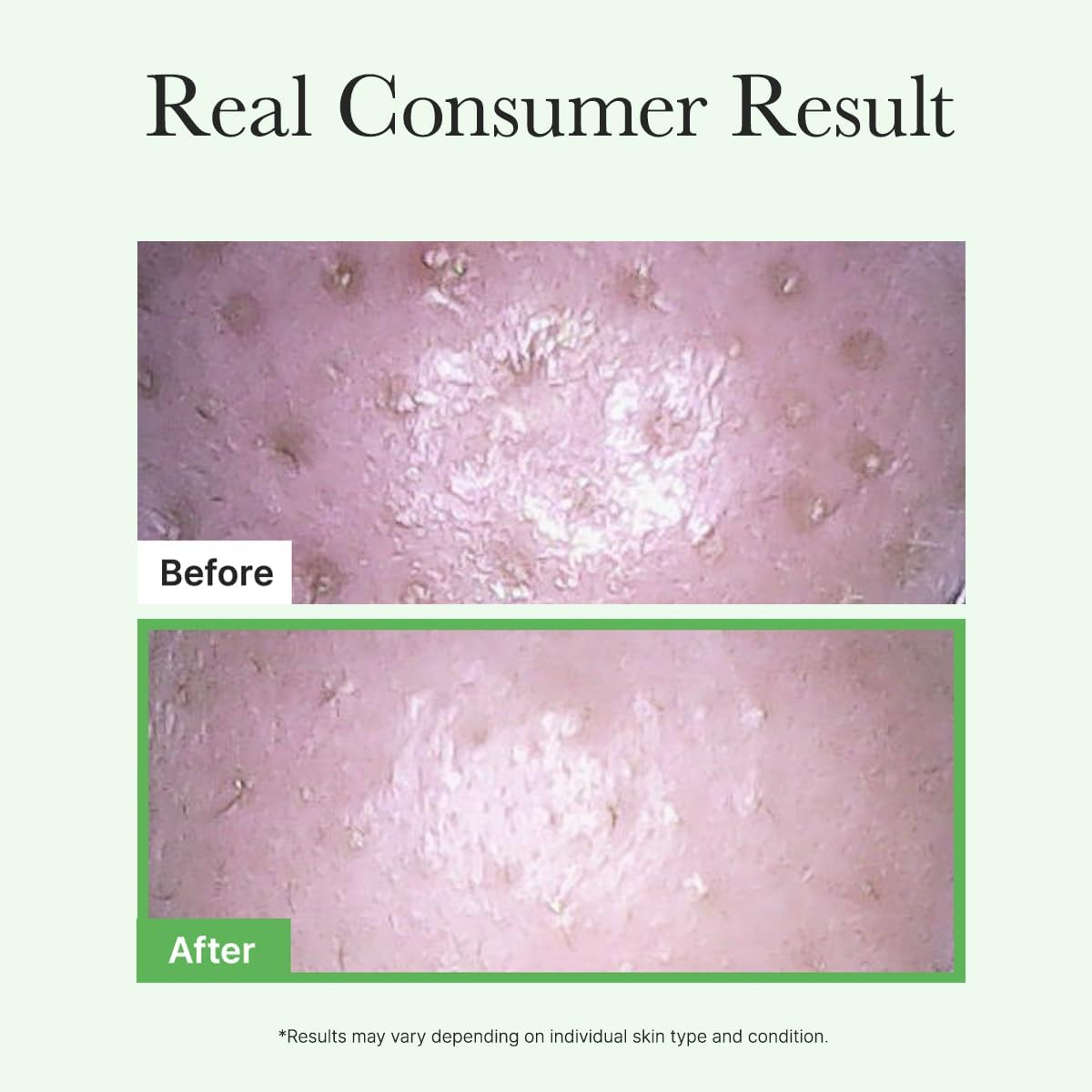 ARENCIA Pore Melt Mochi Makeup-Removing Cleansing Oil image number 2