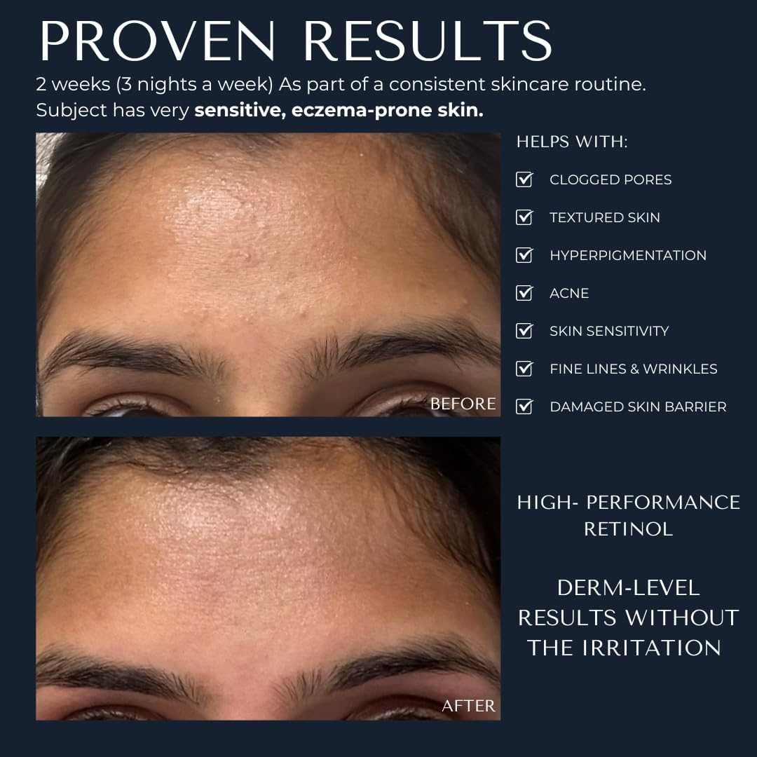 KAASHI 1% Retinol Night Treatment, Anti-Ageing Cream with Ceramides, Peptides & Botanical Extracts for Fine Lines, Uneven Texture & Dark Spots, for All Skin Types image number 3