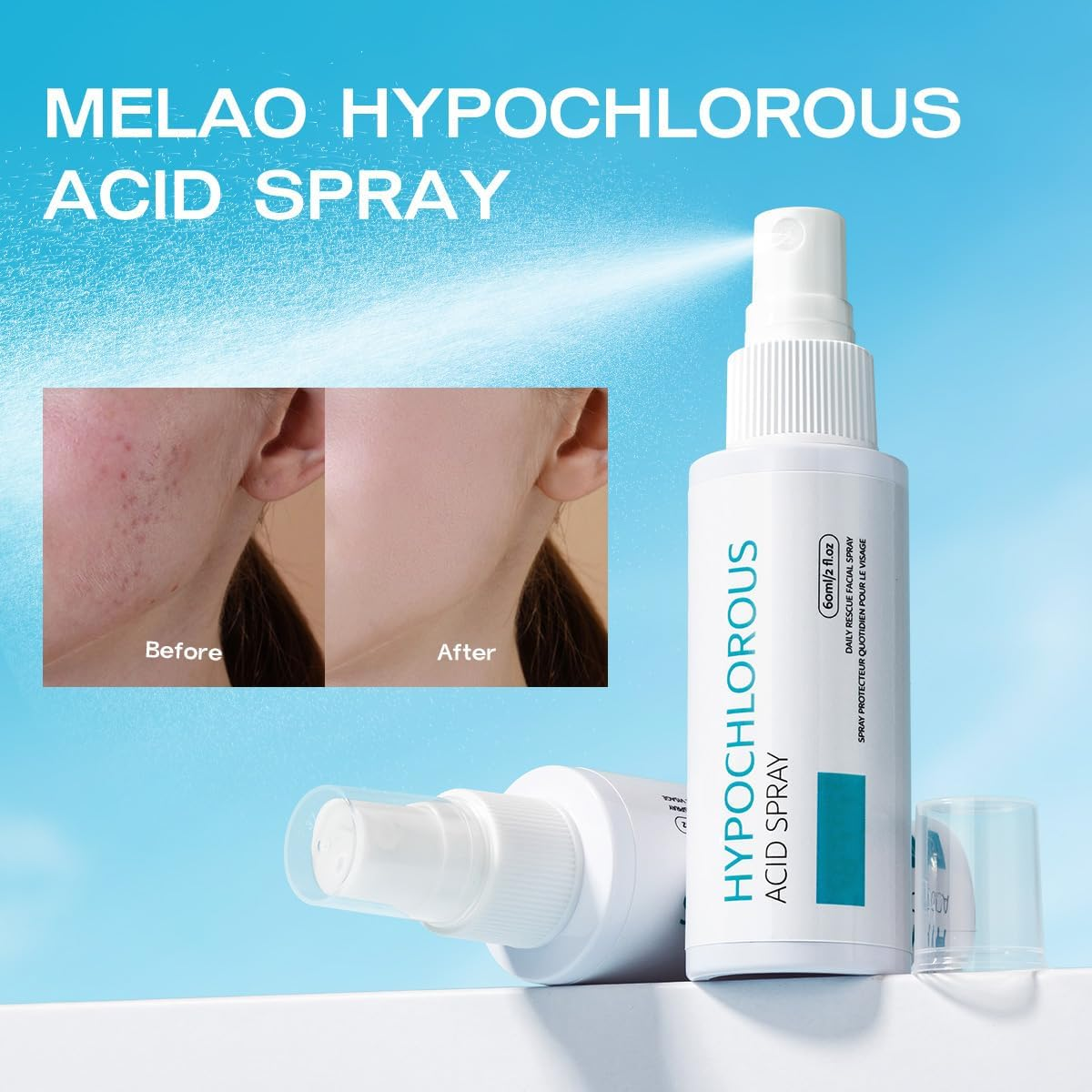Hypochlorous Acid Face and Skin Spray,Safe for Use on Acne Prone Skin, Dry Scalp, Toner, Eye Lash Cleanser, Face and Hand Cleanser - 60Ml image number 3