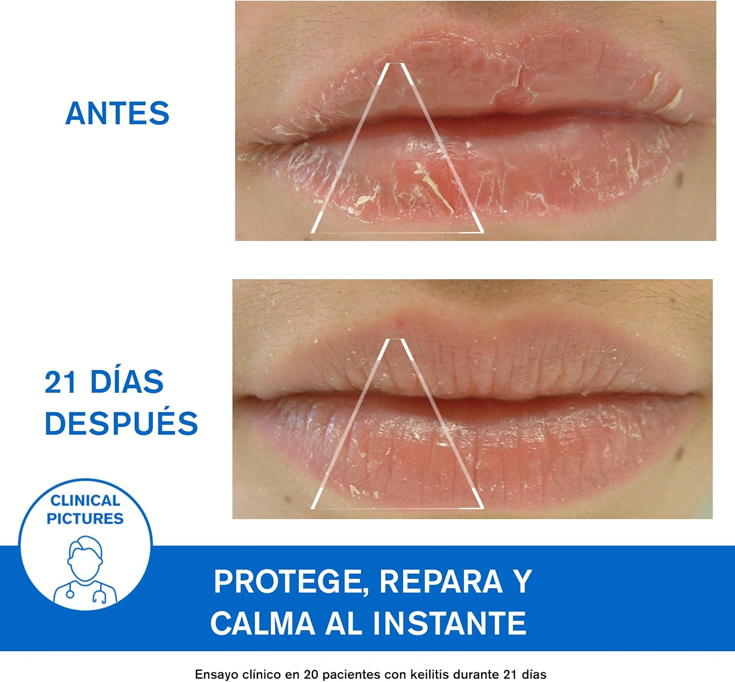 Uriage Bariederm Cica Levres 15 Ml image number 5