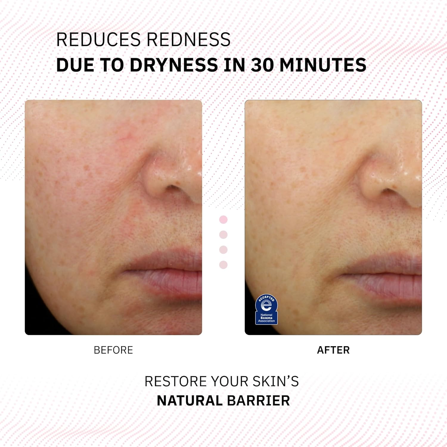 Physiogel Calming Relief Facial Cream, Reduces Redness in 30 Mins, Moisturizer for Men & Women, for Dry, Red, Itchy, Sensitive Skin, Strengthens Skin Barrier, Free of Fragrance,Dermatologically Tested image number 1