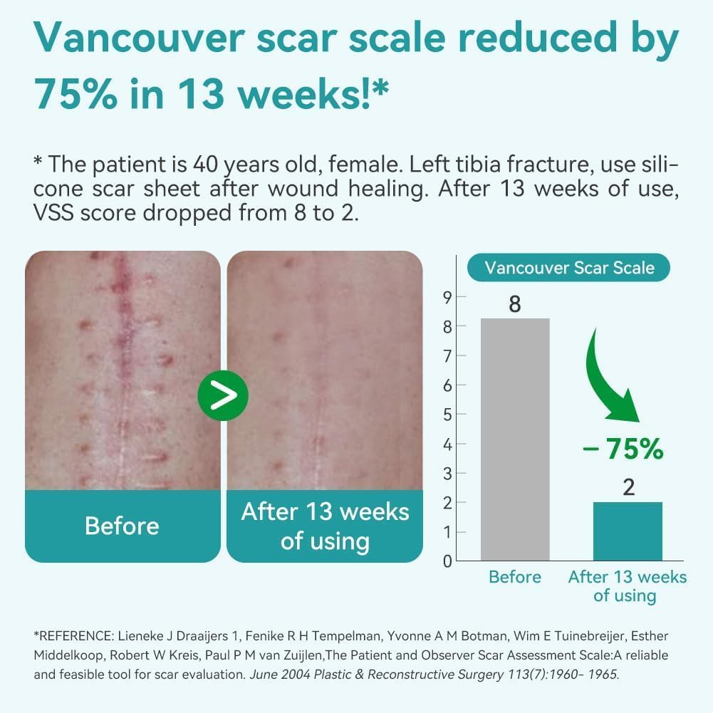 Dimora Medical Grade Silicone Scar Sheets - Ultra Soft Silicone Scar Tape (4Cmx3M), Waterproof Scar Treatment for Surgical Scars, C Section, Tummy Tuck, Keloid Treatment image number 4