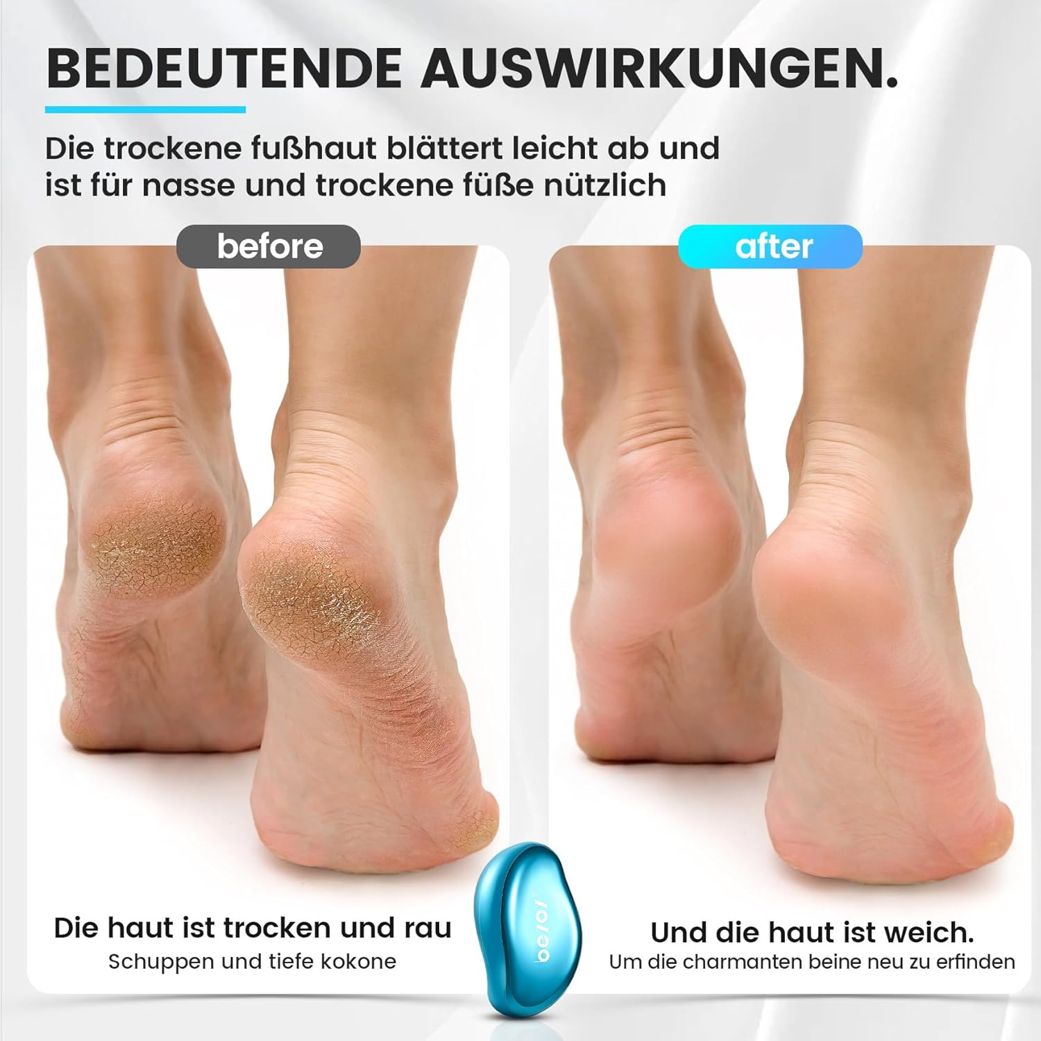 BEZOX 2-In-1 Nano Glass Callus Remover - Effective Nano Glass - Professional Pedicure - Premium Callus File image number 1