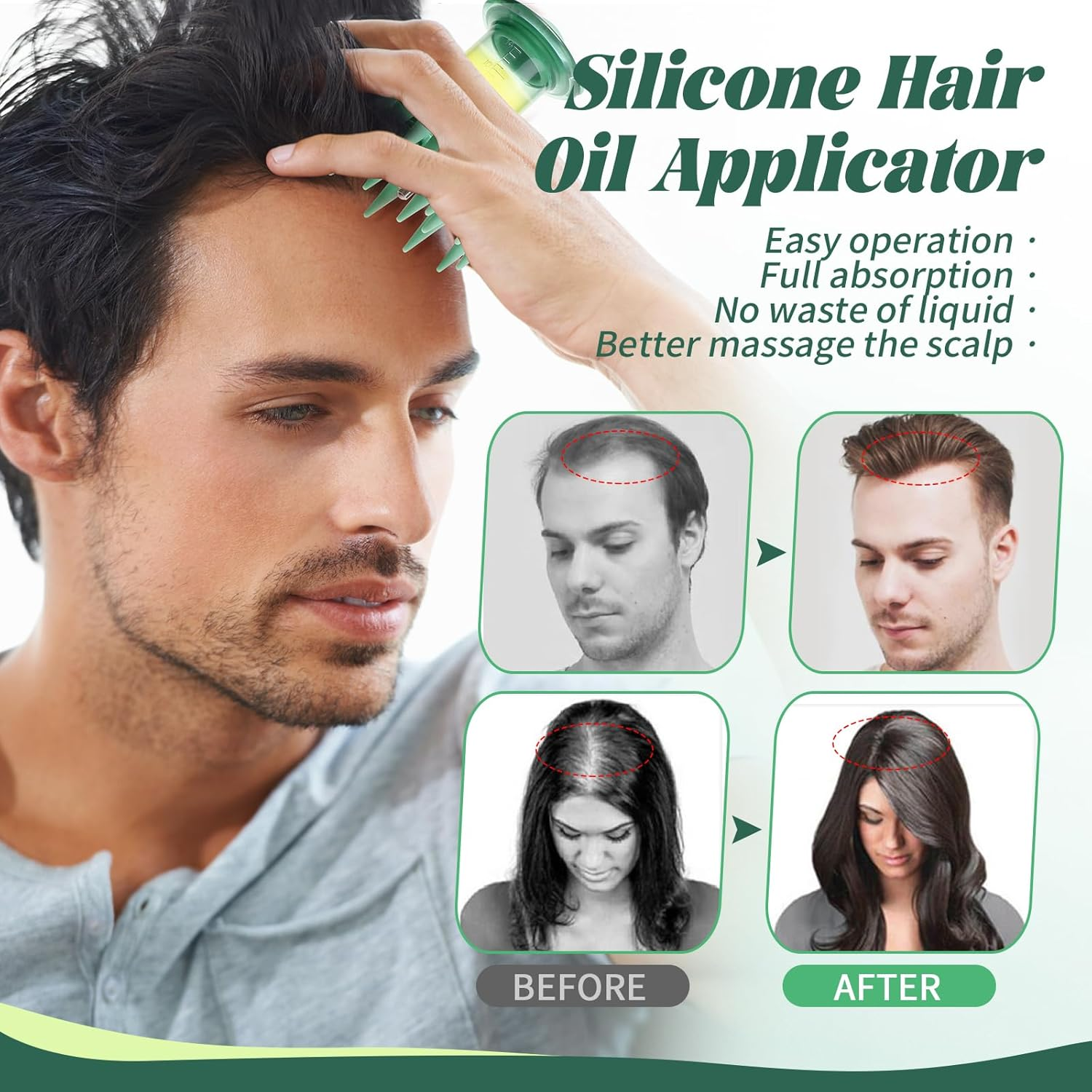 BEAUTLOHAS. Scalp Massager Applicator Comb Silicone Hair Oil & Serum Brush for Even Distribution &ndash; No Mess, Easy-To-Use Scalp Treatment Tool for All Hair Types