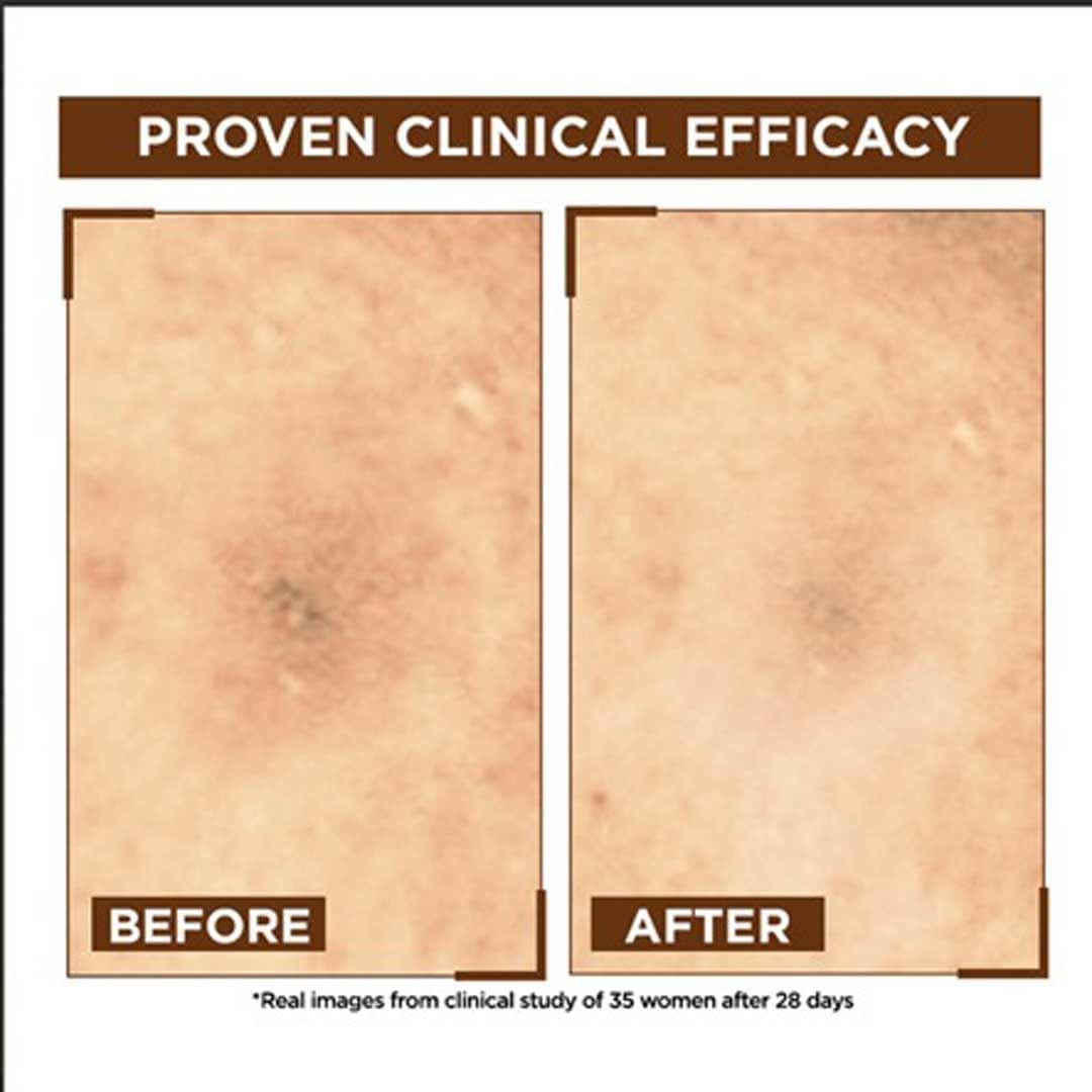 Garnier Bright Complete Night Vitamin C Serum with 10% Pure Vitamin C for Bright Skin, PM Routine Vitamin C Serum Suitable for All Skin Types, 15Ml