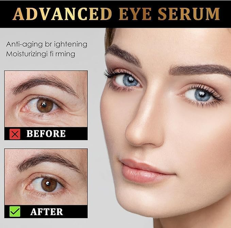 EASYNICE Eraser Roller Ball Essential Oil Eraser Rollerball Castor Oil and Frankincense for Eyes,Time Eraser Oil, Time Eraser Rollerball Organic Castor, Castor Oil and Frankincense Eye Roller image number 6