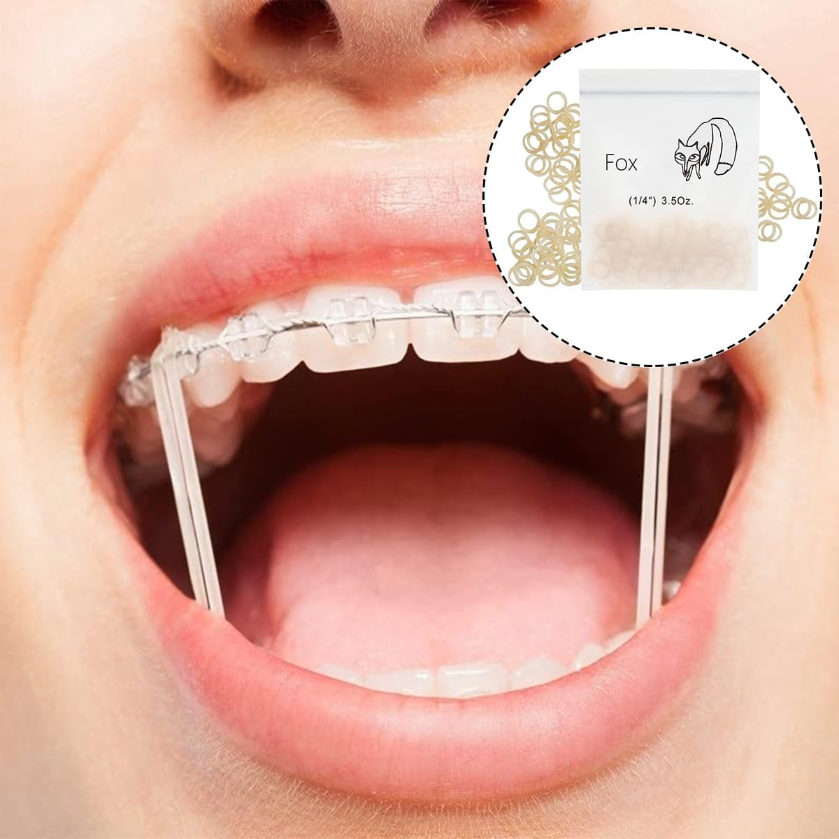 WELANE Orthodontic Elastic Rubber Bands, 200PCS 1/4" Orthodontic Rubber Band for Crooked Teeth, Tooth Gaps, Hairbands, Braids (Fox, 3.5 Oz)