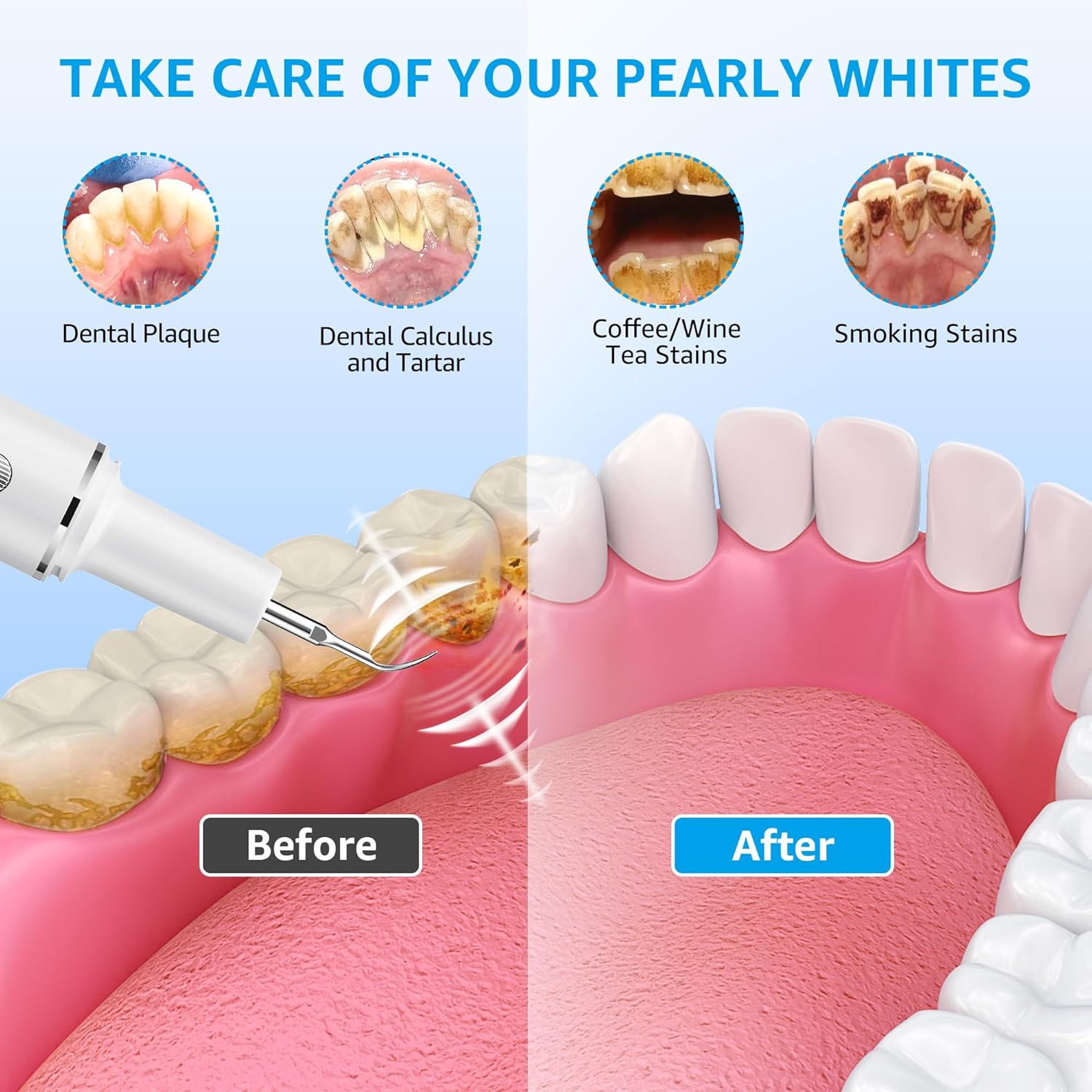 Teeth Cleaning Kit Plaque Remover for Teeth, Portable Dental Plaque Remover Tool with LED, Plaque Blaster for Human Teeth with 3 Modes, Tooth Scraper Plaque Tartar Remover for Teeth with Dental Tools (White) image number 6