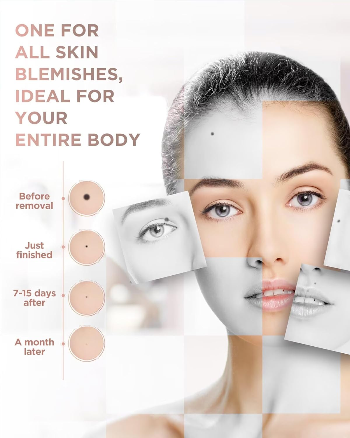 Skin Tag Remover - for Home Use, Portable Removal Kit for Mole, Wart and Skin Tag for Women and Girls, Fast Acting, Safe and Easy to Use image number 1