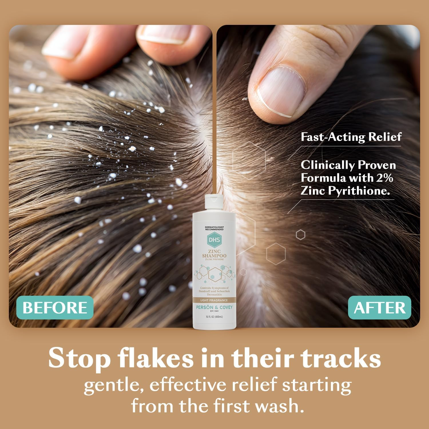 DHS Zinc Shampoo Pyrithione Zinc 2%, 470Ml - 2Pc image number 5