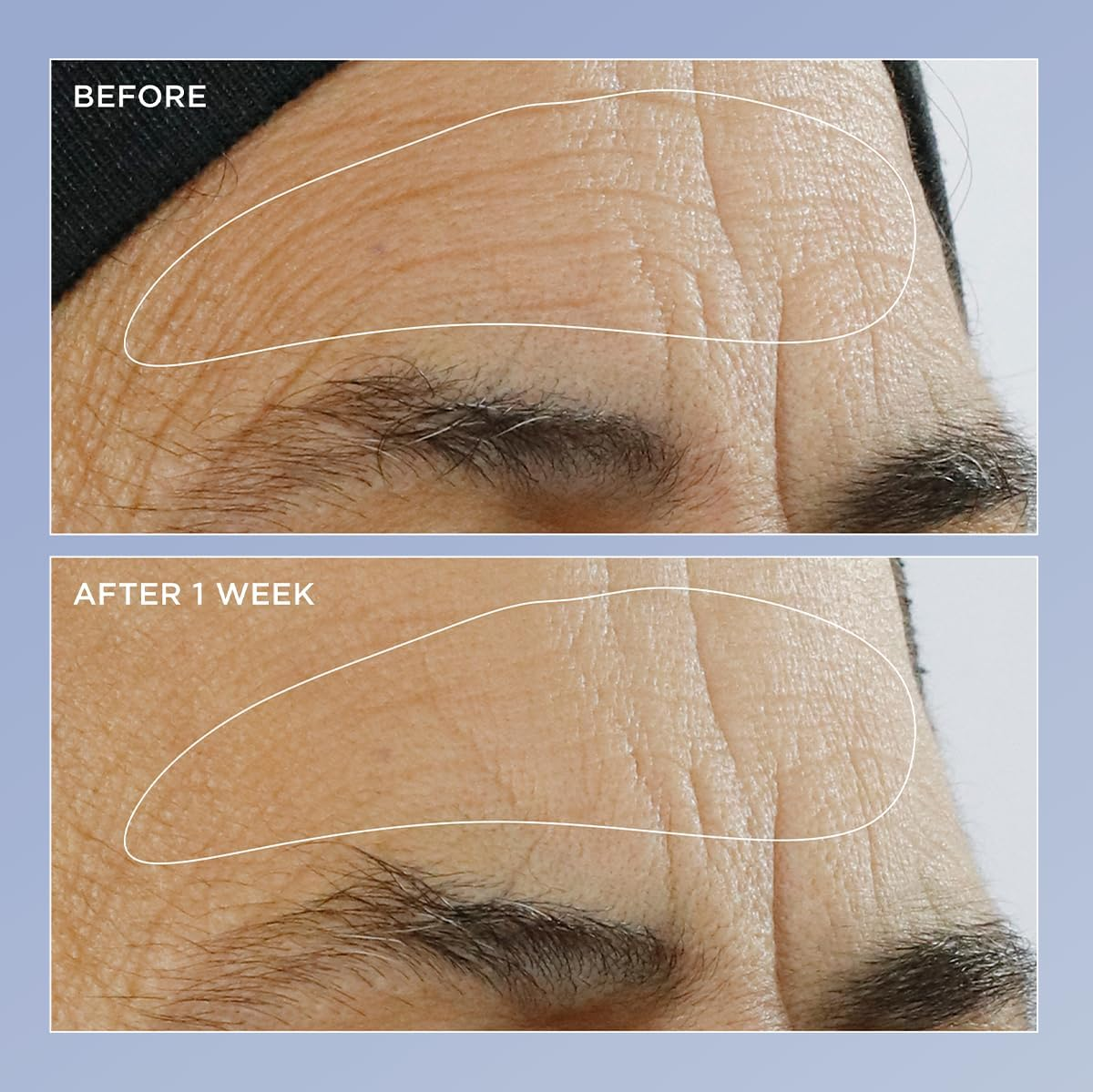 High Potency Triple Retinol Renewal Serum by Perricone MD for Unisex - 2 Oz Serum image number 1