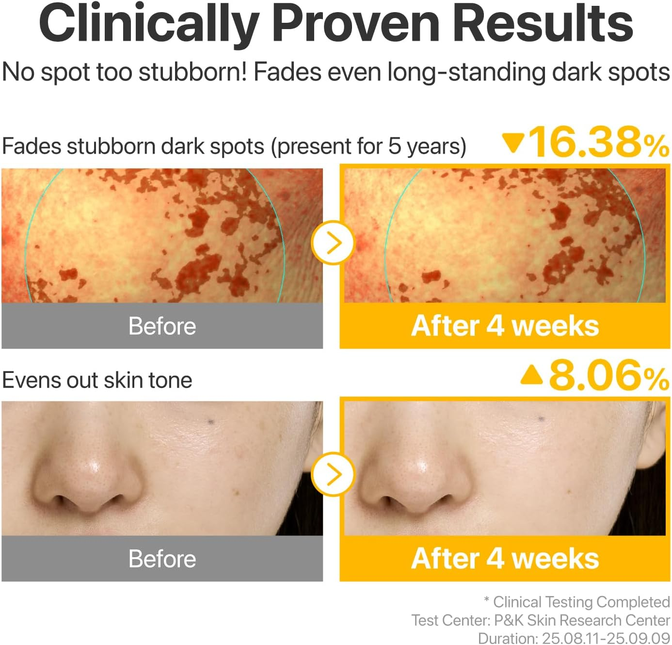 Numbuzin No.5 Serum | Glutathione TXA Advanced Dark Spot Ampoule Concentrate | Tranexamic Acid, Niacinamide | Hyperpigmentation| Suitable for Sensitive Skin, Korean Skincare | 10.7G image number 3