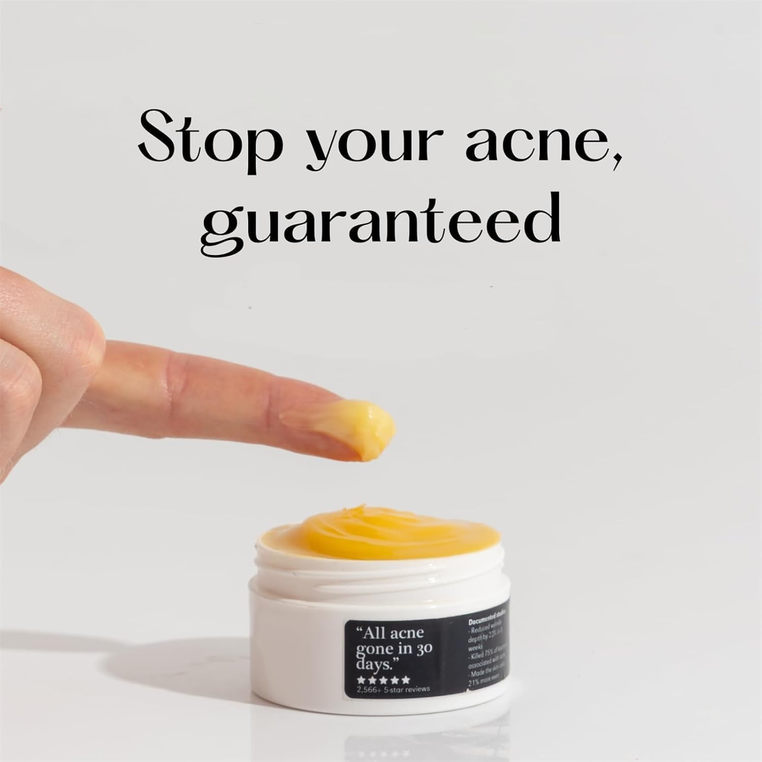 Organics Acne & Redness Killer Acne Remove Skin Care Set Natural and Mild Formula Natural and Mild Formula for All Skin Types