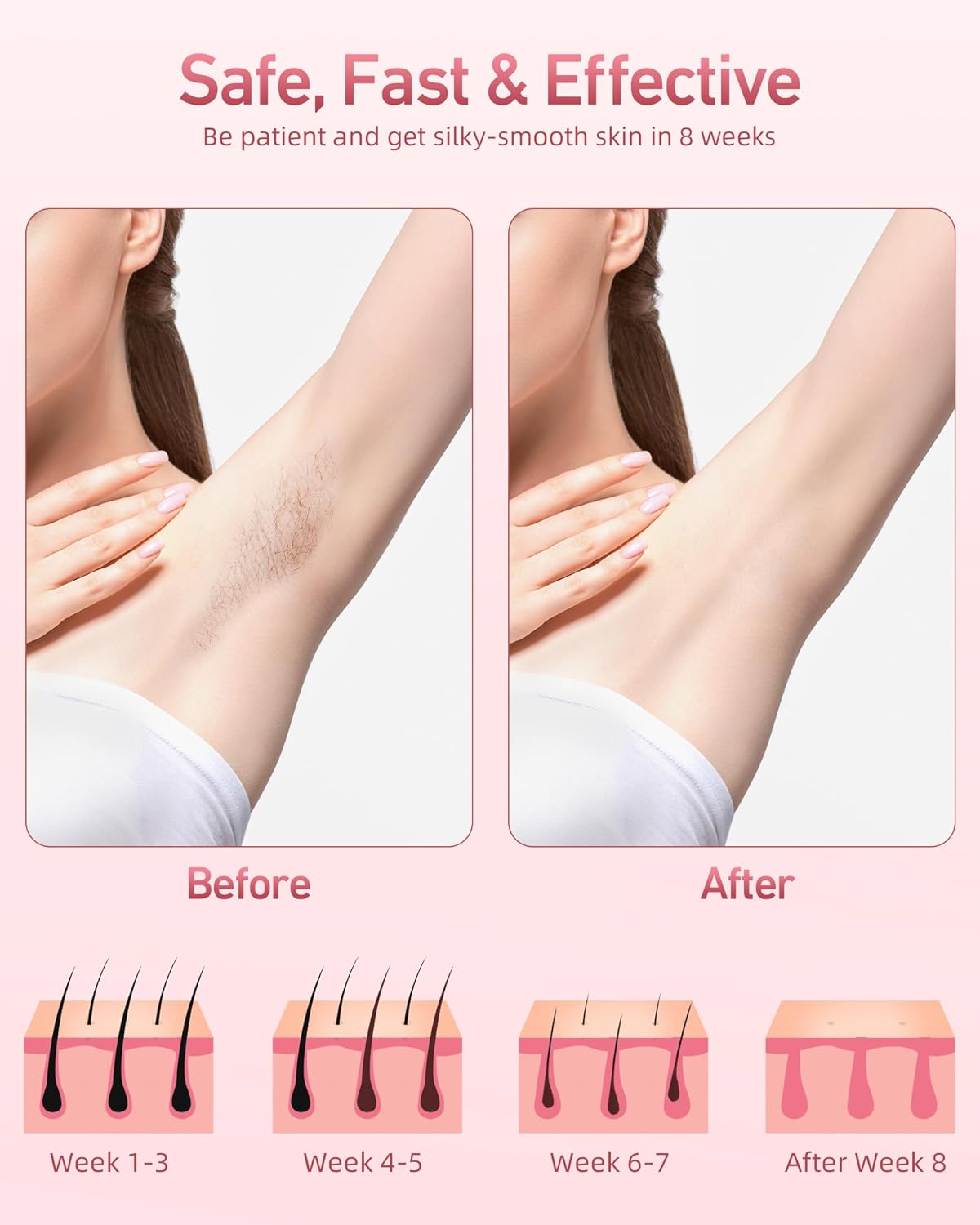 Hair Removal Device, IPL Hair Removal, Laser Hair Removal for Women and Men 999,999 Flashes Permanent for Facial Facial Legs Arms Bikini Line Whole Body Use At-Home(Model: TFDA06S-A) image number 5