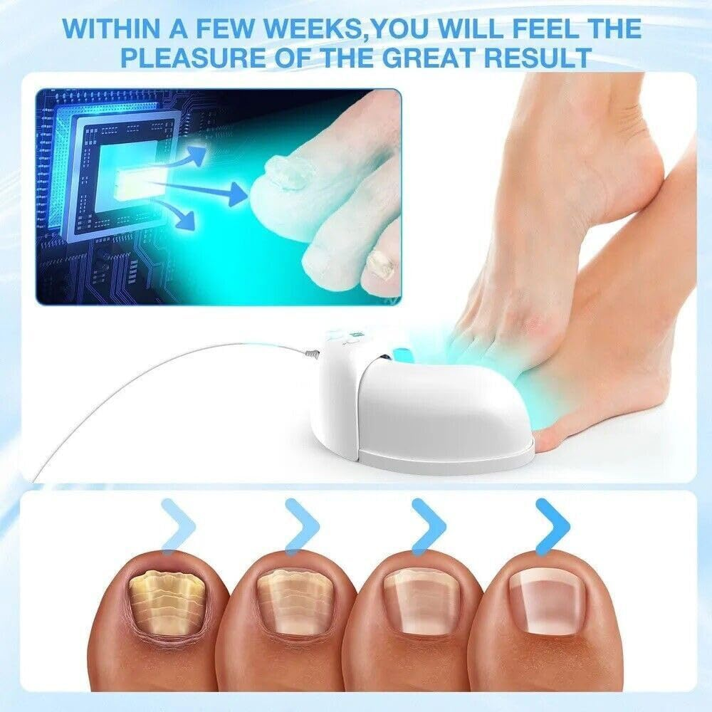 Nail Fungus Cleaning Laser Device Blue Light Nail Therapy for Fingernail Toenail image number 2