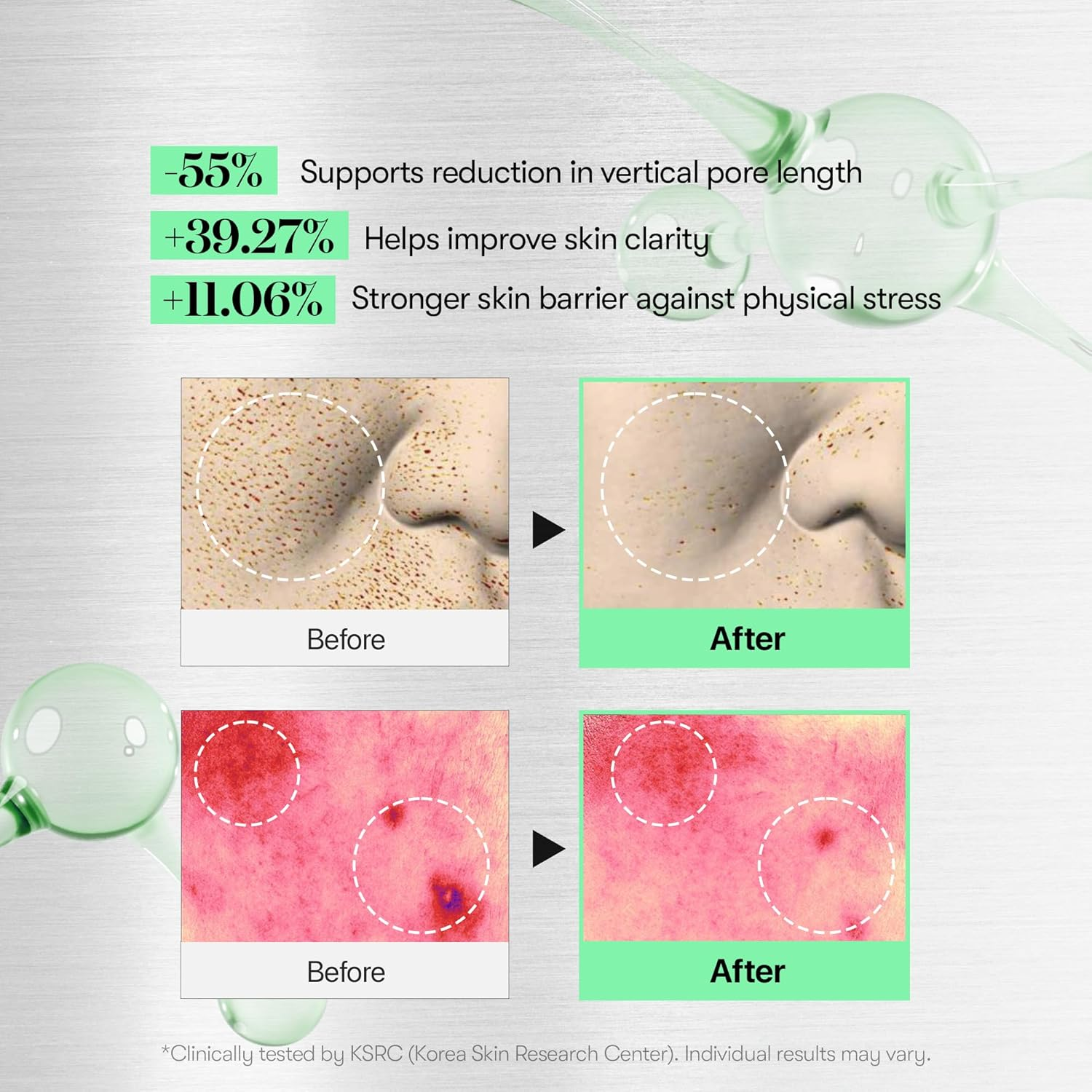 VT COSMETICS CICA Reedle Shot 100, Daily Night Exosome, CICA Reedle Shot Serum with Hyaluronic Acid & Propolis &ndash; for Smooth, Radiant-Looking Skin1.69Fl Oz (50Ml) image number 4