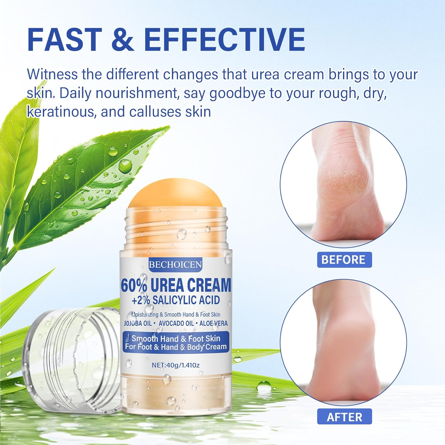 Urea Cream 60 Percent for Feet with 2% Salicylic Acid - Heel Balm,Foot Cream for Dry Cracked Feet,Cracked Heel Repair,Exfoliate Foot Skin,40G,1Pcs image number 5