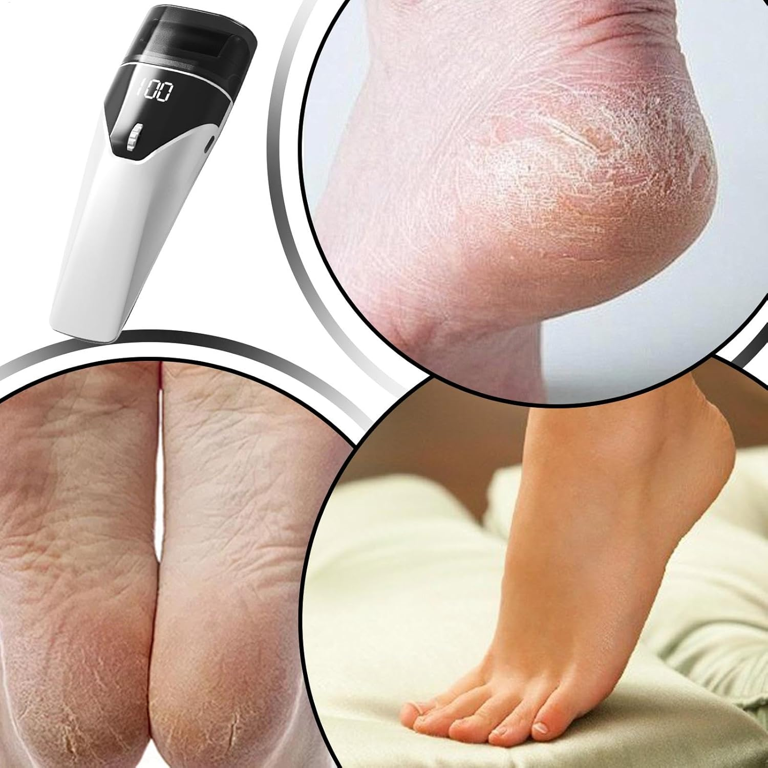 Weqizuerqi Foot File Adjustable | Rechargeable Foot Scrubber Rough Skin Remover,Auxiliary Light Design Men Women Automatic Pedicure Tool for Father, Mother, Wife image number 6