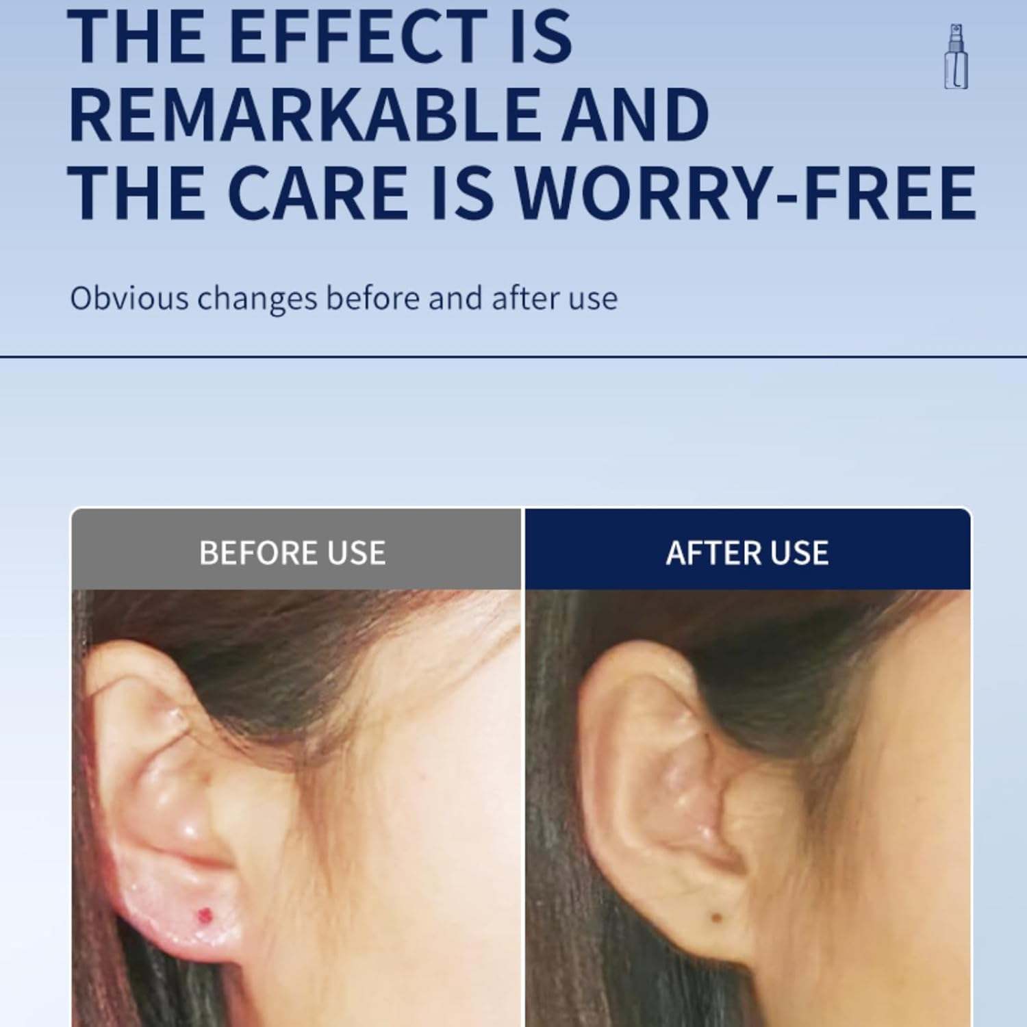 Piercing Aftercare Spray - 60Ml, for Cleansing & Comfort with Sea Salt, Aloe Vera and Rosemary. Suitable for Ear, Nose, Lip, Eyebrow, Belly & Body Piercings. image number 5