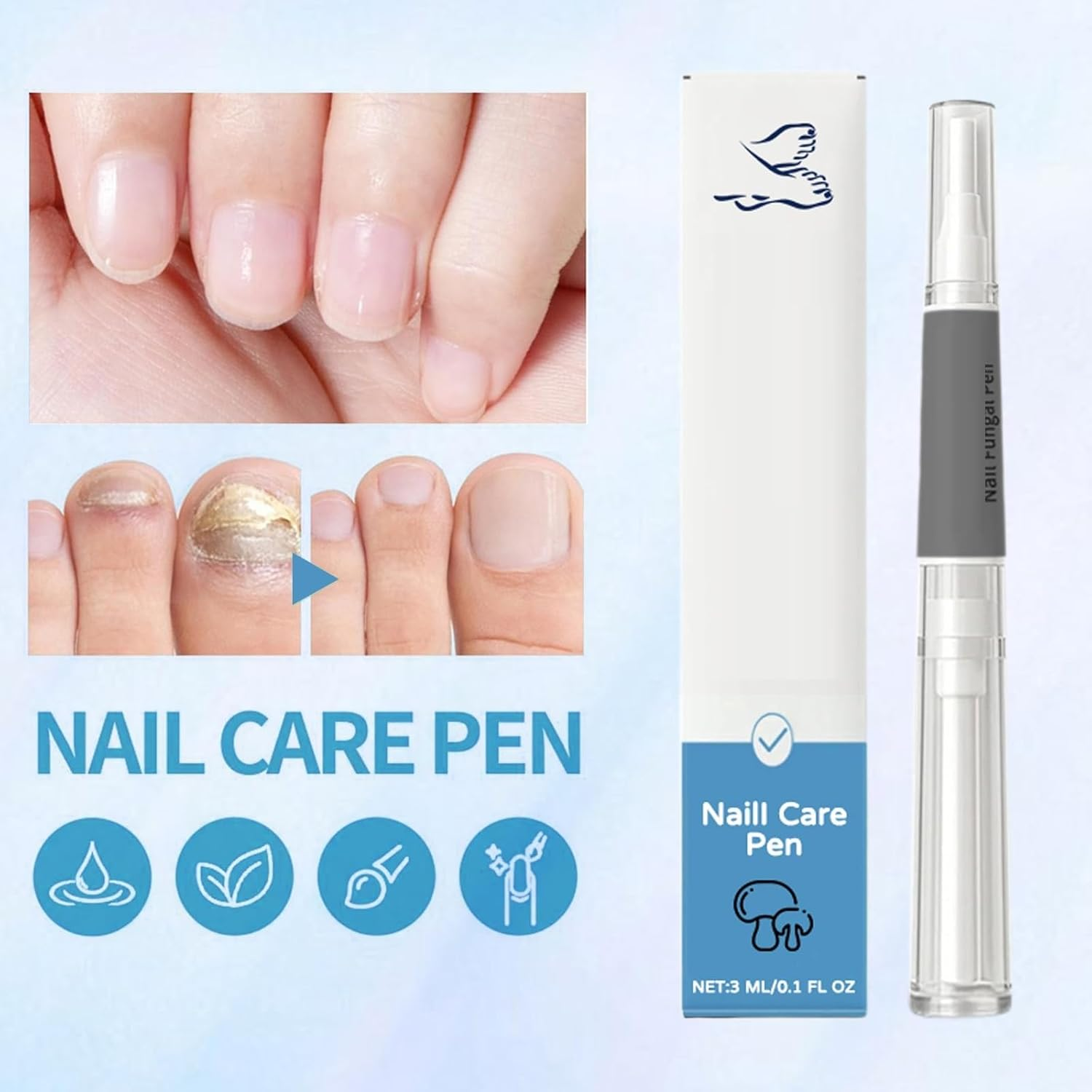 Antifungal Nail Pen for Toenails and Fingernails, Extra Strength Fungus Treatment & Repair Serum with Natural Ingredients, Nail Strengthener and Growth Support (2 PCS) image number 2