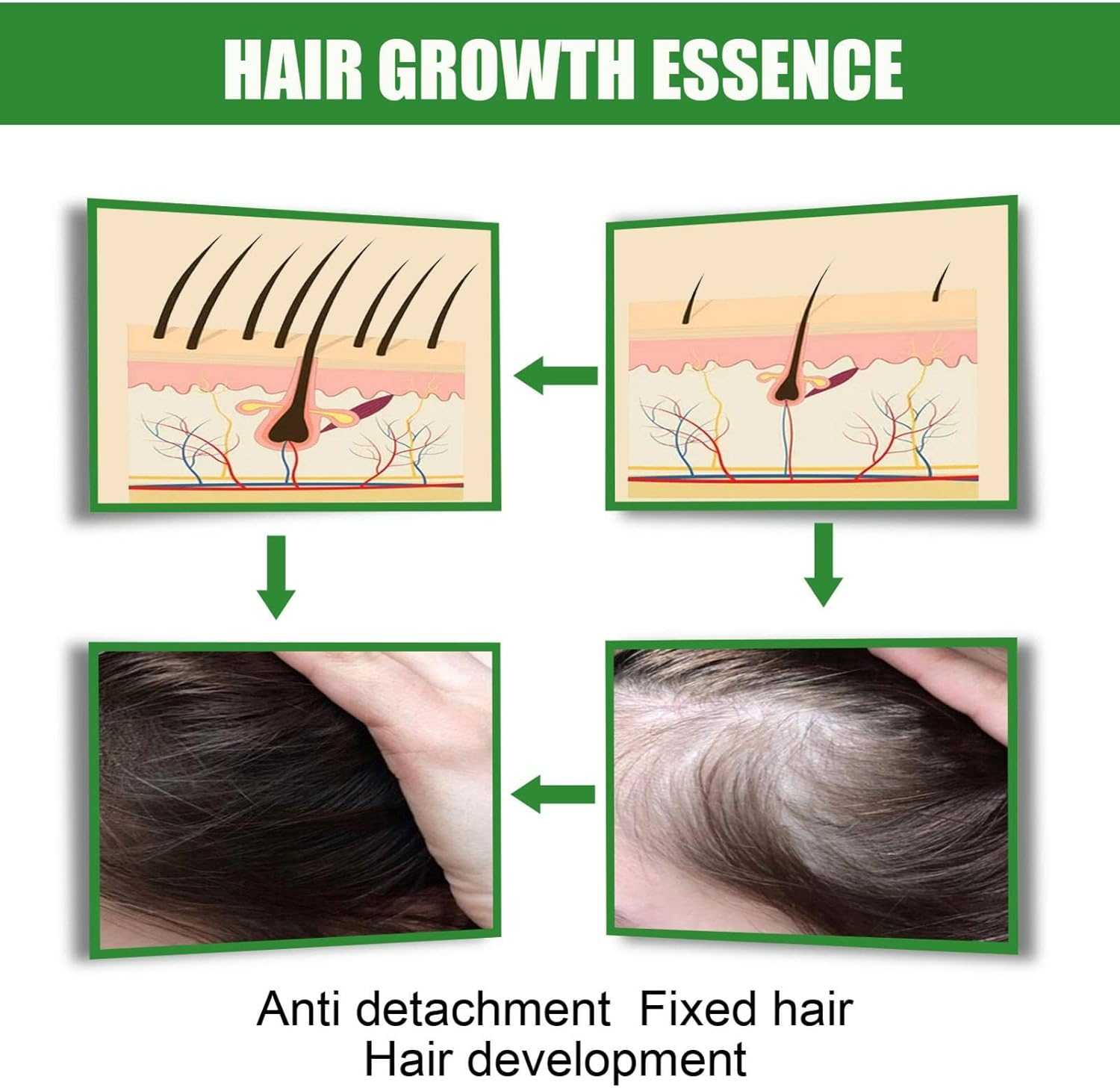 5 Pcs Organic Growth Ginger Spray | Hair Regrowth Spray for Hair Rapid Growth | Safe and Healthy Organic Growth Hair Care Nutrition Spray Dobooo image number 2