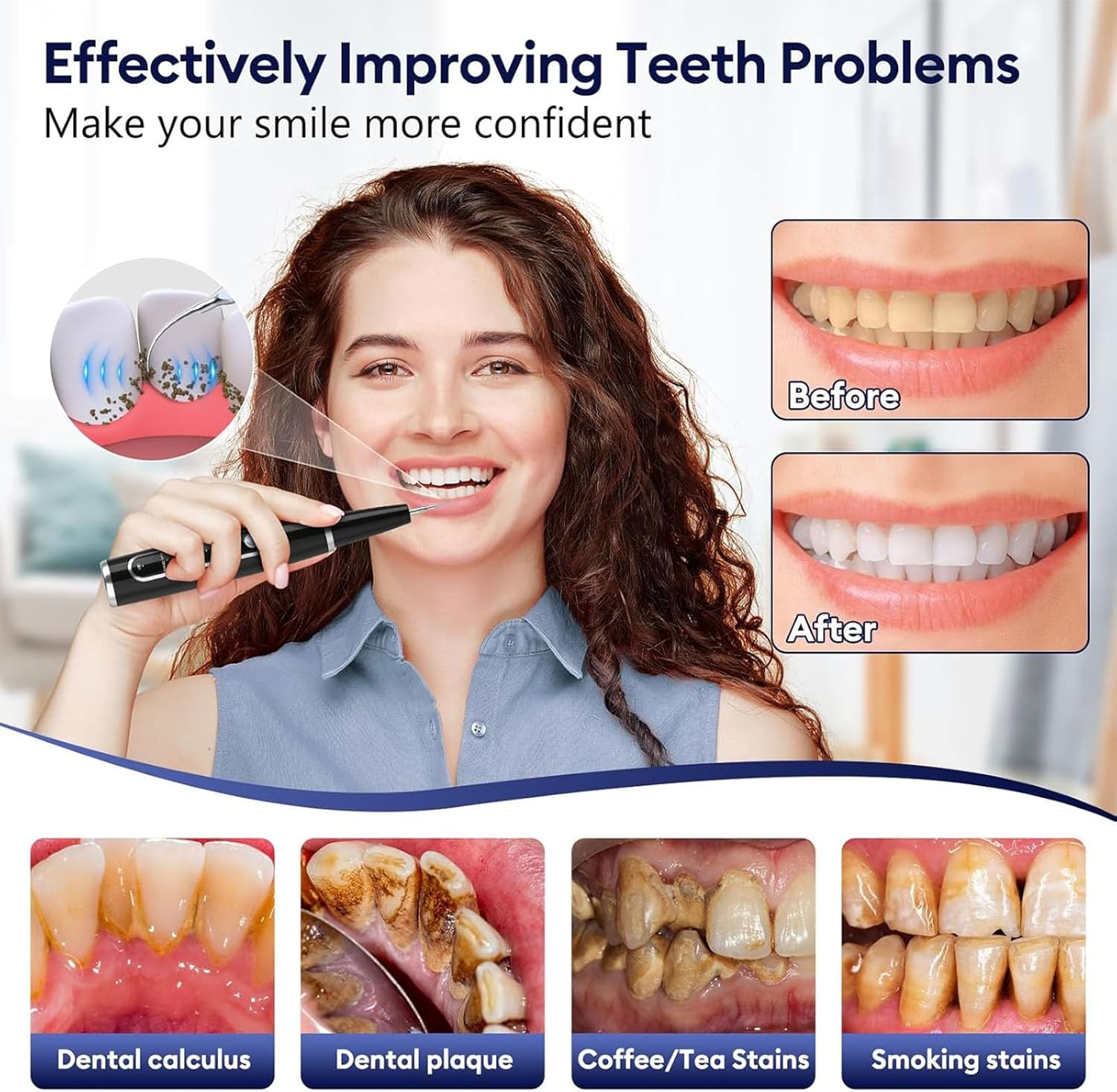 Oolong 5-Mode Dental Plaque Remover, Rechargeable Tartar Cleaner with 4 Heads & LED Light, Waterproof, Portable Teeth Cleaning Kit for Home/Travel