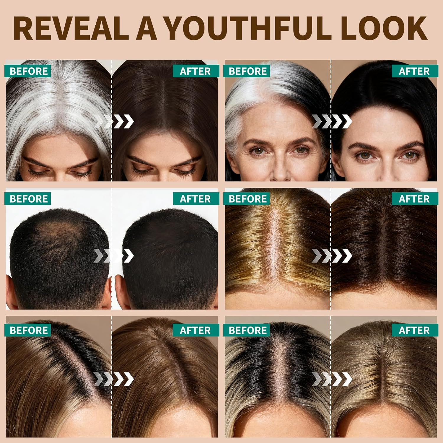 KIMUSE Hairline Powder, Root Touch up Hair Color, Instantly Conceals Hair Loss, Bald Spot Thin Hair Powder with Dual-Ended Hairline Brush for Women and Men, Transfer-Proof & Sweat-Proof (Medium Brown) - Dark Brown image number 6