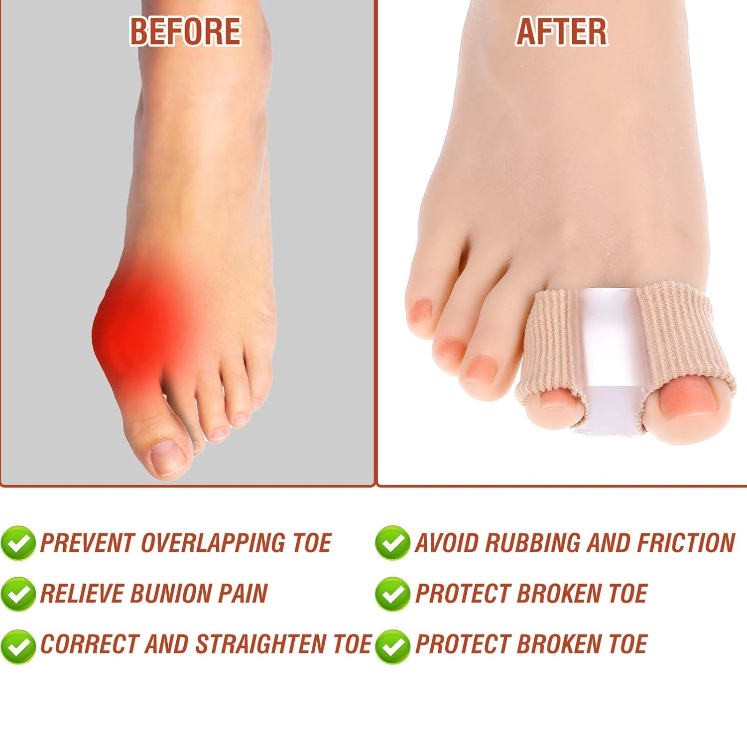 6Pcs Gel Bunion Corrector for Women Big Toe Straightener, Elastic Fabric Toe Separators Bunion Corrector for Women Overlapping Toes, Breathable Hammer Toe Spacers for Men Bunion Foot Pain Relief image number 4