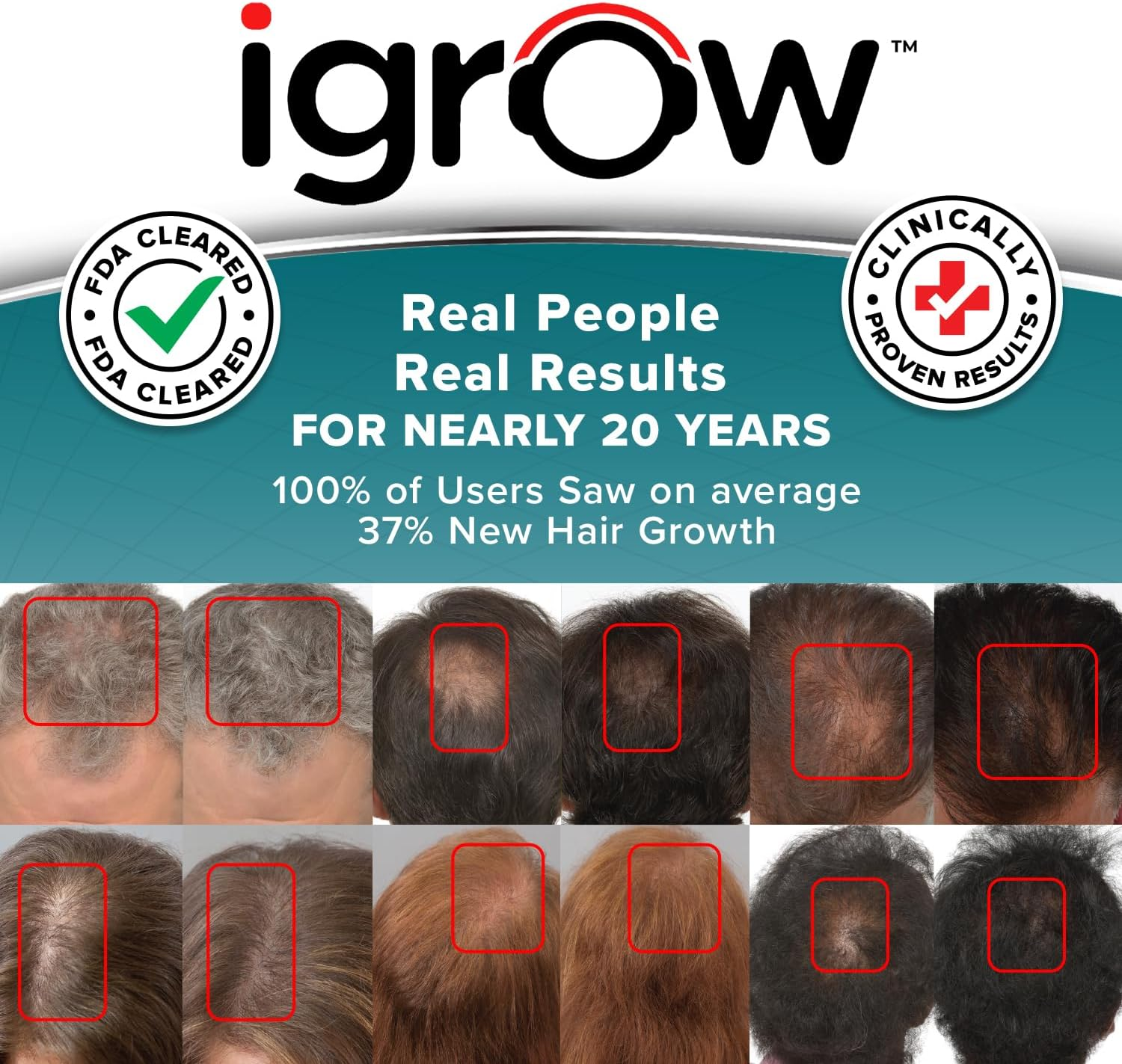 Igrow Laser Hair Growth Helmet: Restoration & Regrowth Treatment System for Hair Loss - Natural Thinning, Balding, and Alopecia Solution for Women and Men - Fda Cleared Low Level Laser Device image number 4