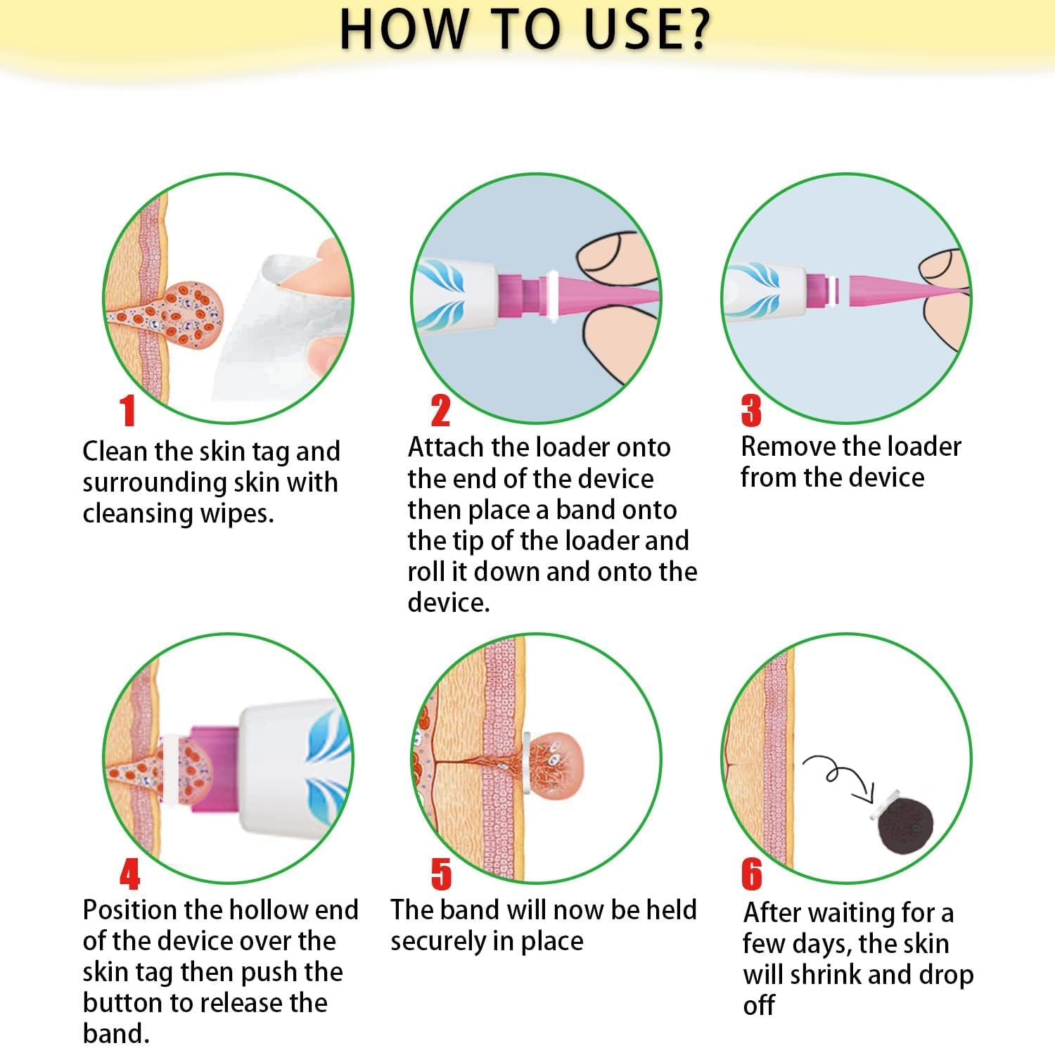 2-IN-1 Skin Tag Tool for 2-8 Mm Size Skin Tags Painless Skin Tag Removal Kit with 36 Repair Patches and 10 Cleansing Wipes Easy to Use for Most Body Parts image number 2