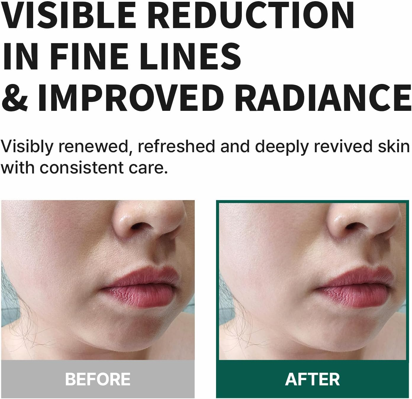 Blanche Extra Concentrate Serum 30Ml, Korean Vegan Skincare, Anti-Aging, Wrinkle Care, Retinol Alternative Bakuchiol, White Truffle image number 2