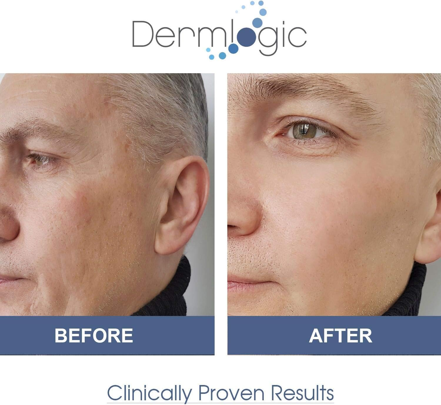 Dark Spot Corrector Cream- Visibly Fades & Repair Skin Discoloration from Dark Spots, Sun Spots, Age Spots, Acne Scars, Brown Spots, Freckles. Hydroquinone Free, No Harsh Chemicals for Face & Body image number 5