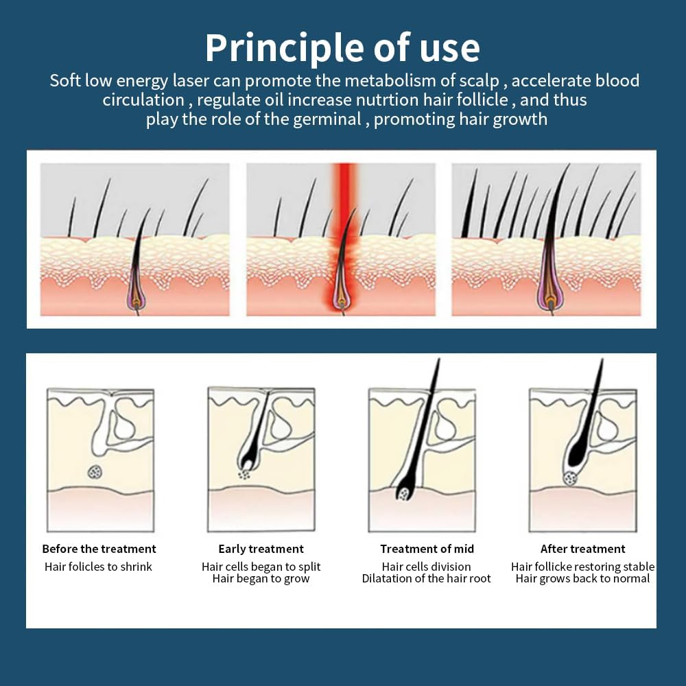 Red Light Hair Growth Beanie, Revitalize Your Hair with the Power Laser Hair Growth Cap, Red Light Laser Hair Growth Cap, Red Light Hair Growth Hat(Black Plug-In) image number 4