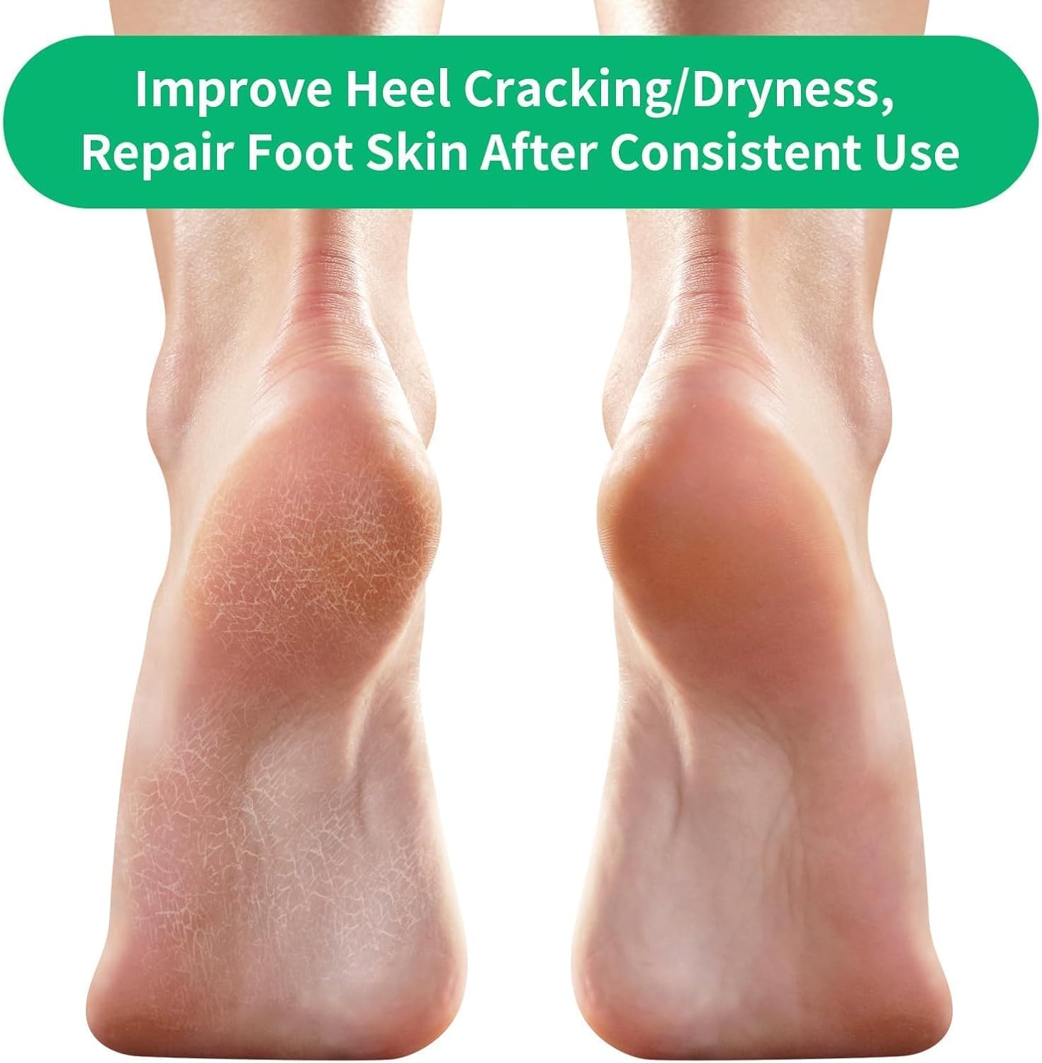 YBVABE Moisturizing Gel Heel Socks - 12Pieces Soothing Spa Therapy for Dry, Cracked Heels, Includes Gel Lined Cotton Blend Socks for Day and Night Heel Care, Unisex, One Size Fits Most image number 1