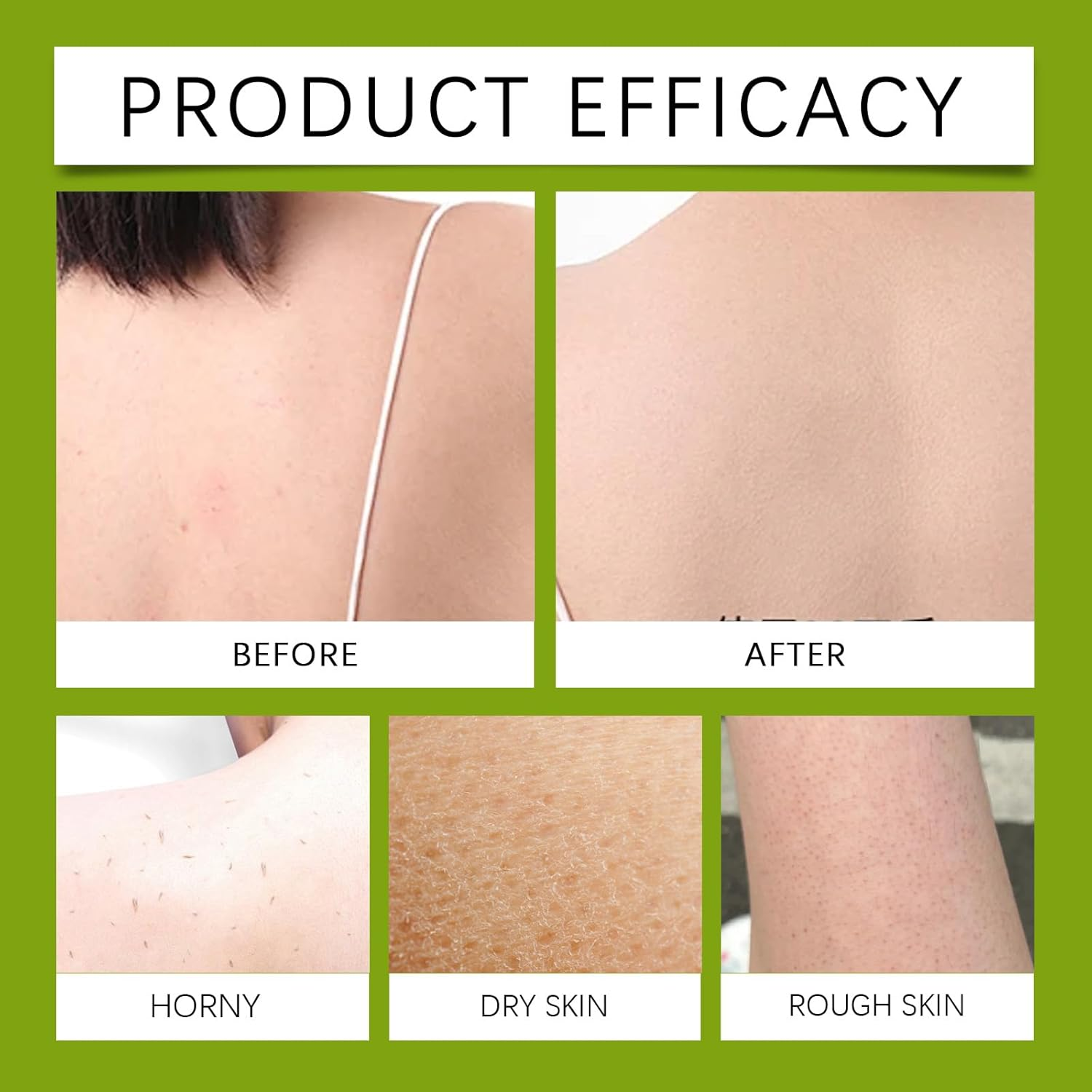 QPJUVC Tea Tree Oil Soap Bar, 100G Natural Plant-Based Bar Soap - Deep Cleansing Face & Body Wash with Olive Oil & Coconut Oil, Odor Control, Refreshing Cleanse, Sweat Removal & Soothes Skin (3) image number 2