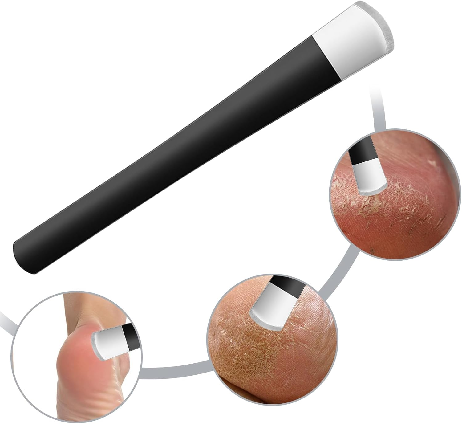 6 PCS Pedicure Knife Set, Ingrown Toenail Removal Kit Stainless Steel Removal Pedicure Scraper with Storage Box Professional Foot Scraper Callus Shaver Foot Care for Dead Dry Hard Cracked Skin image number 3