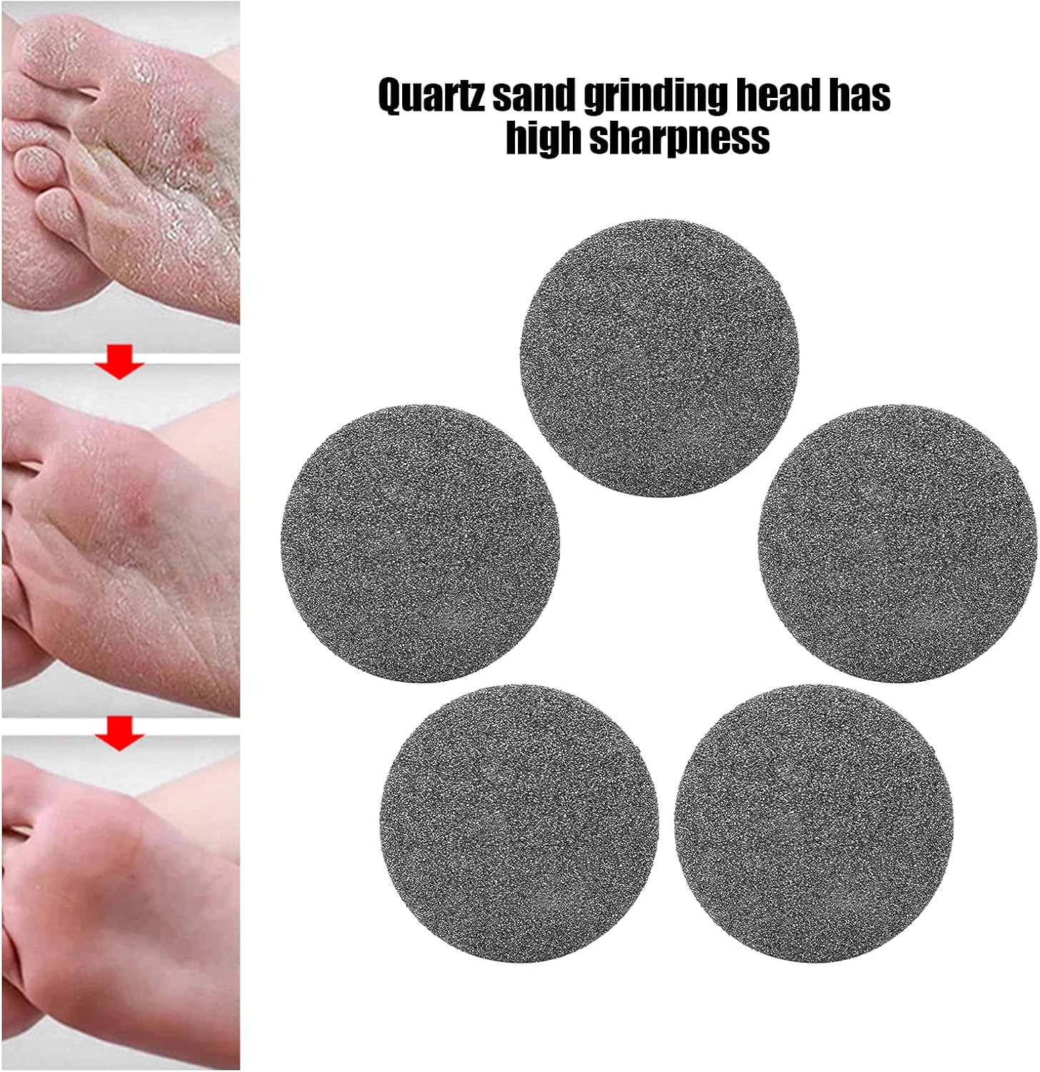 Watris Veiyi Replacement Sandpaper Discs, Pack of 5 Callus Remover Hard Skin Replacement Foot Grinding Head Tool for Dead Skin Callus Remover Head Foot Files (Black) image number 1