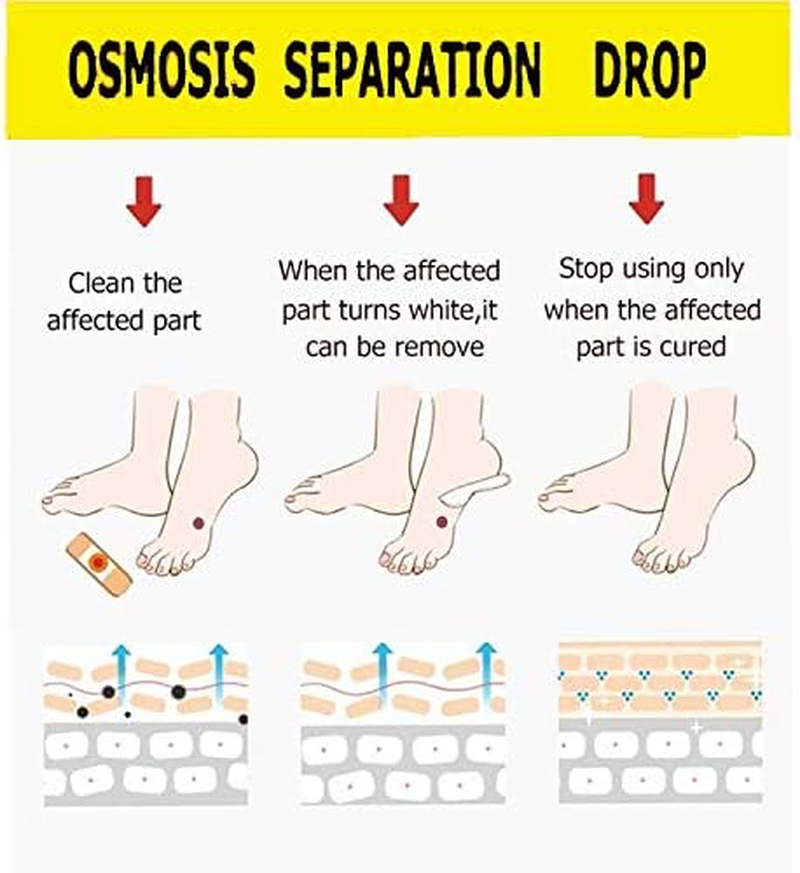 Reppkyh 24 Pieces Corn Removers for Feet, Corn Removers for Toe, Foot Corn-Toe Corn-Callus Removal, Corn Remover Feet image number 5