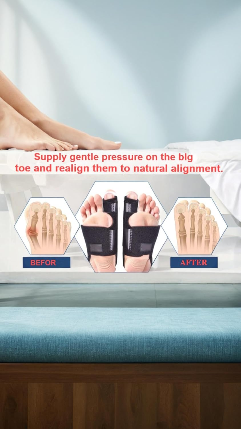 Honwor Bunion Corrector & Toe Straightener - Adjustable Orthopedic Splint for Hallux Valgus & Pain Relief - Fits Both Feet image number 2