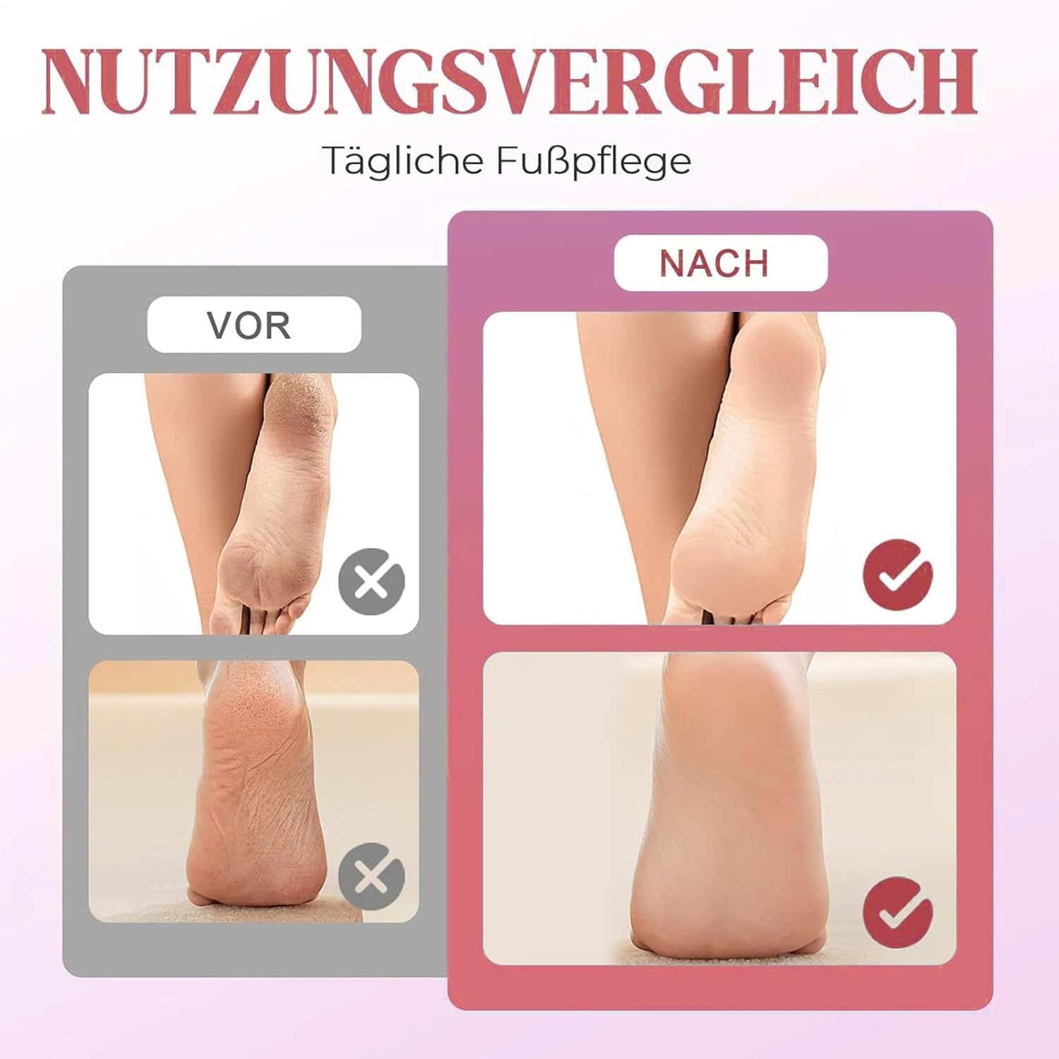 Callus Remover for Feet,Electric Foot File Callus Remover | Electronic File Scrubber Pedicure Kit for Cracked Hard Dead Skin Peeling Heel Care image number 1