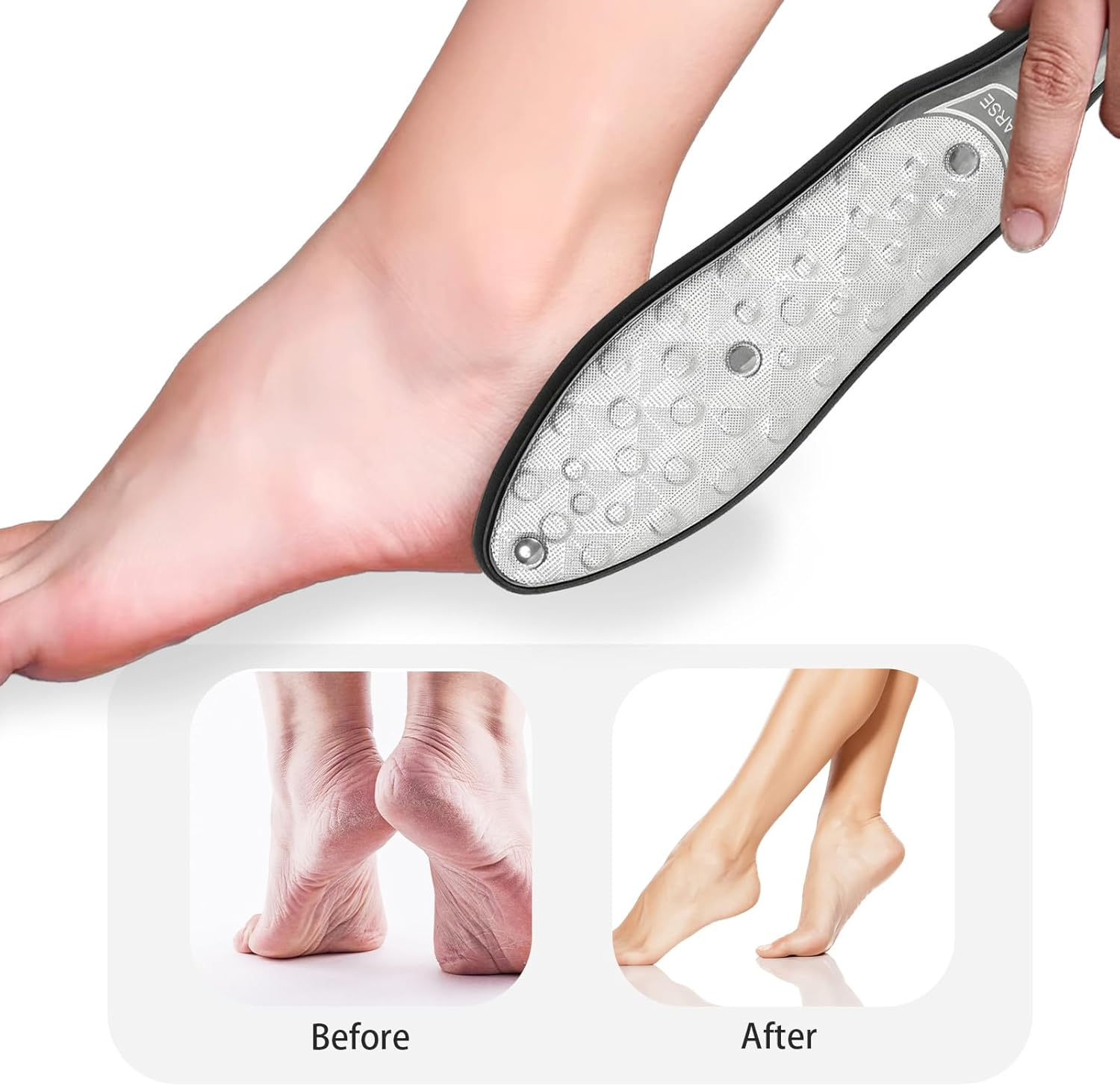 Tiyiyok Callus Remover, Professional Callus Remover for Foot Care, Callus Rasp and Pedicure Set, Removes Dry Skin on Feet, Heels, Quick & Pain-Free, Callus Removal, Foot Effectively image number 6
