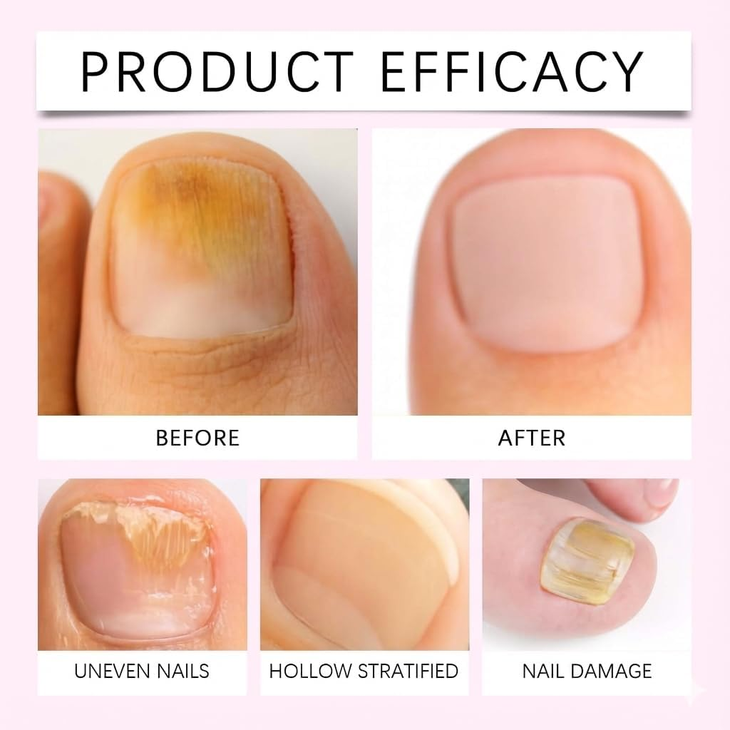 Cuticle Oil Pusher Pen, Cuticle Remover Care Strengthener, Deeply Hydrating & Nourishing Cuticles Conditioner Oil, Moisturizing and Brightening Nail Cuticles Remover Pen, Toenail Care Serum (3PCS)