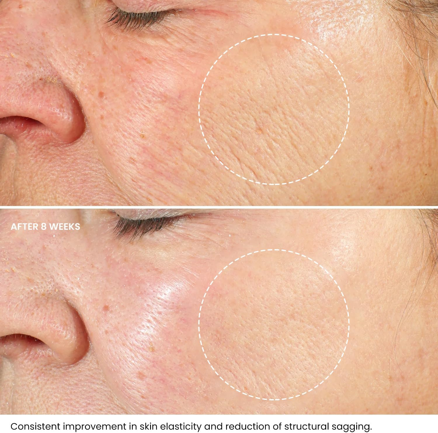 Night Moisturizer for Face with Hyaluronic Acid and Vitamin E for Women & Men image number 3