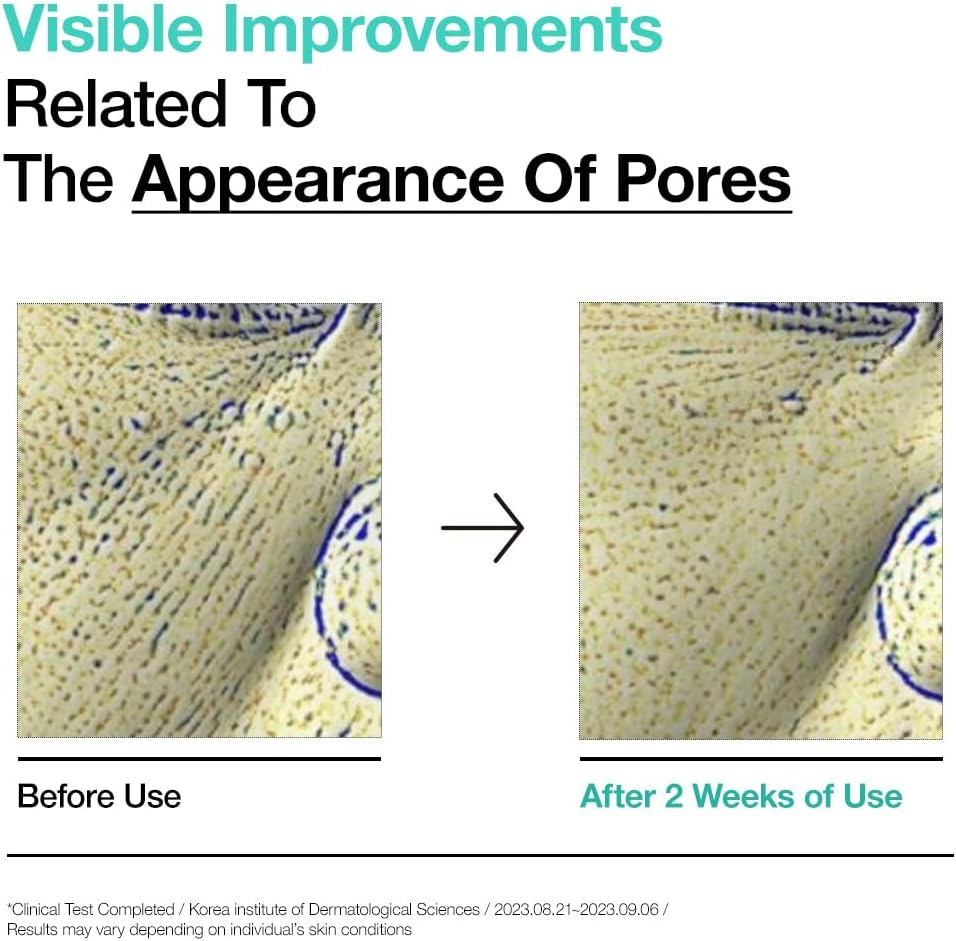 Anua BHA 2% Gentle Exfoliating Toner 200 Ml