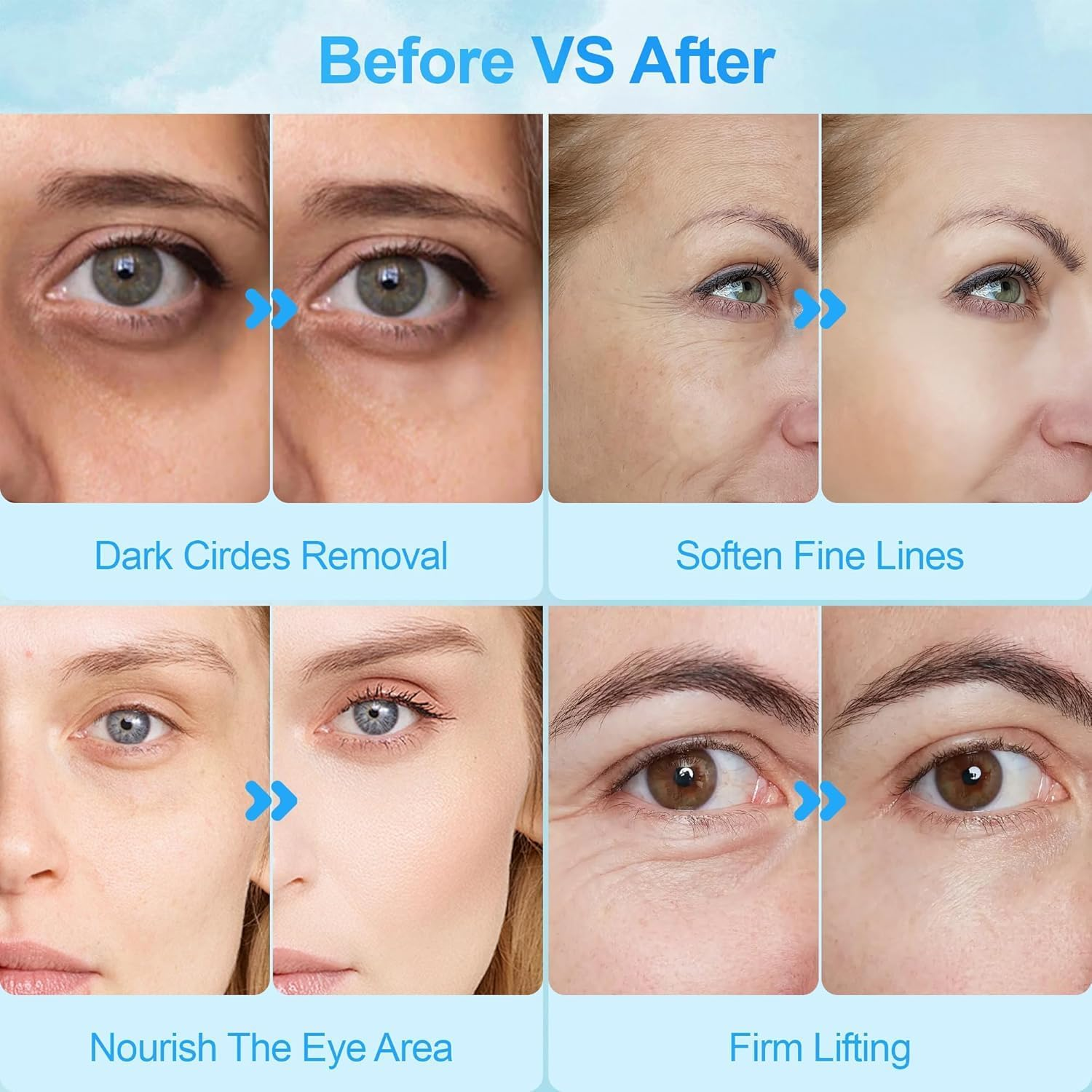 Collagen under Eye Gel Patches, under Eye Patches for Puffy Eyes & Dark Circles, Collagen & Retinol for Brightening & Hydration image number 1